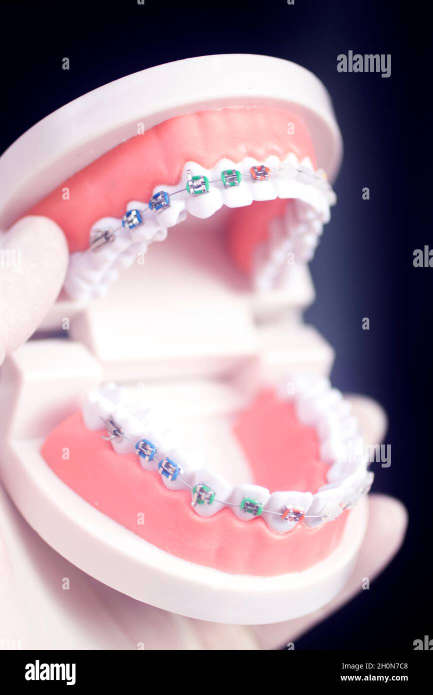 Dental teeth aligner bracket teaching student model showing gums and