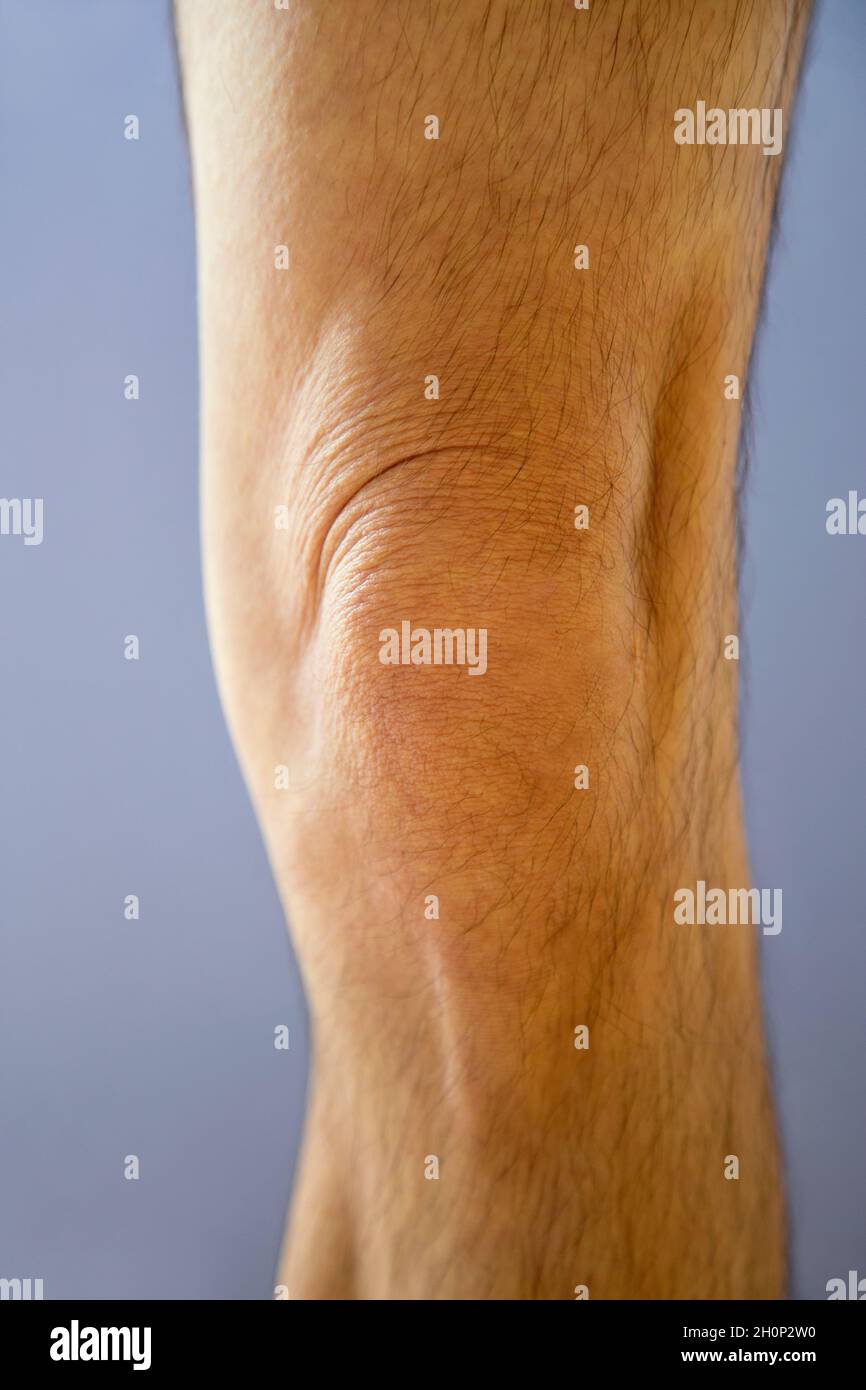 An adult male's knee Stock Photo