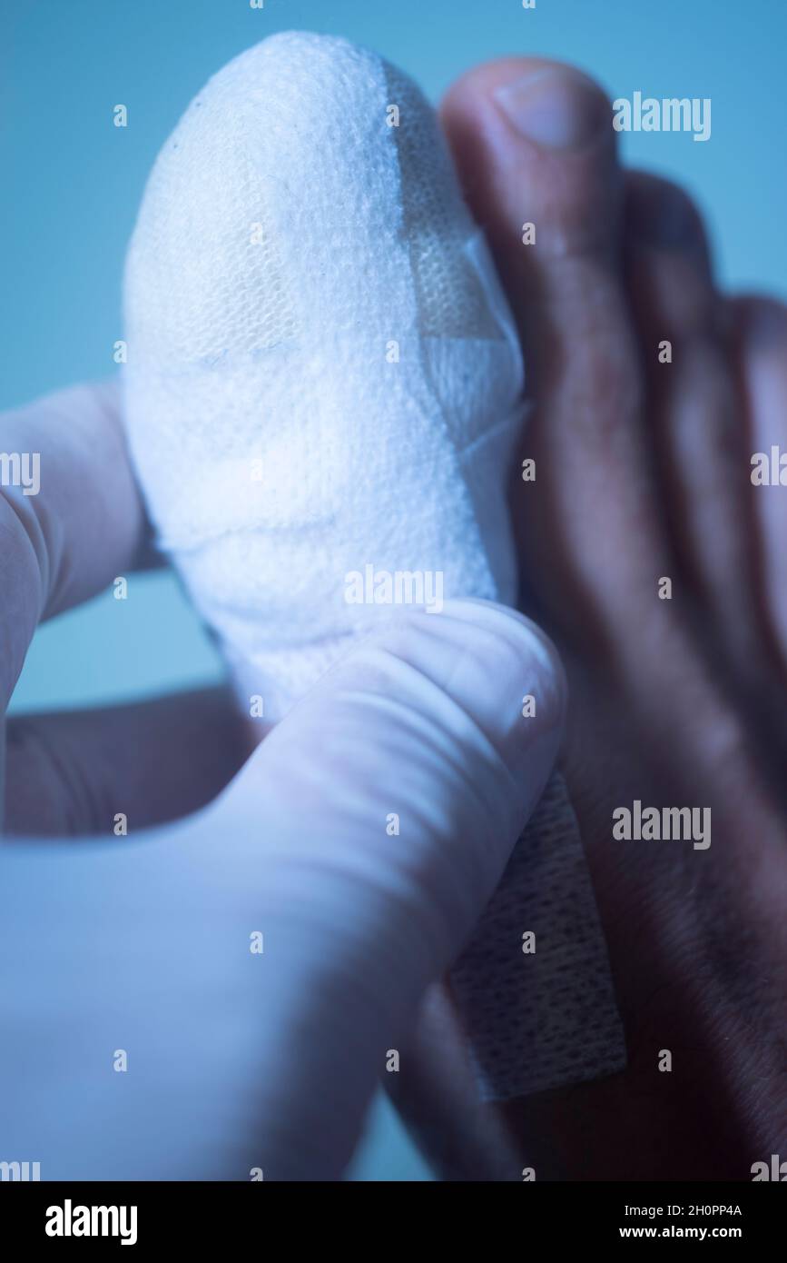Foot big toe bandage injured feet in medical clinic hospital center