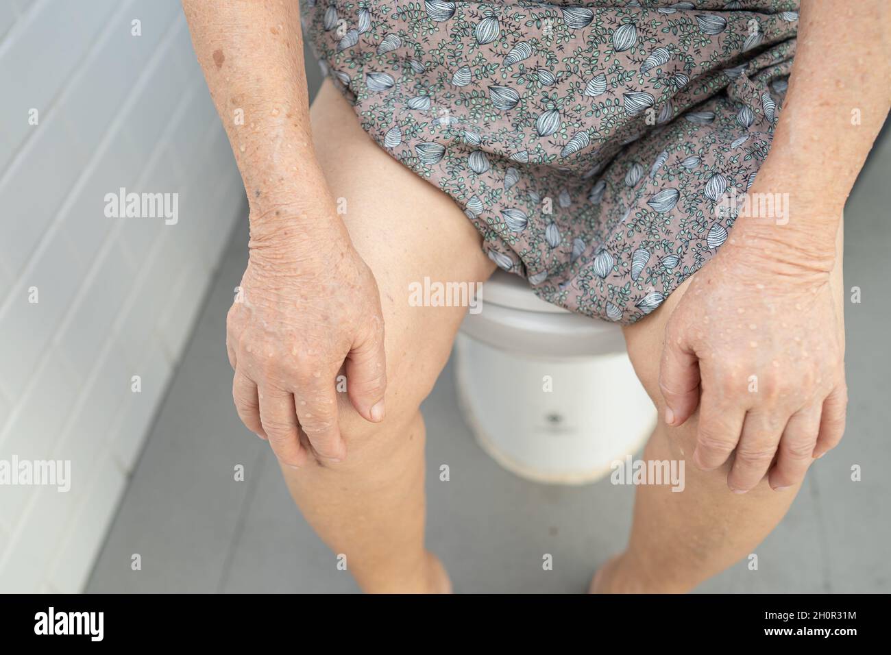 Asian senior or elderly old lady woman patient sitting on flush toilet in bathroom. Stock Photo