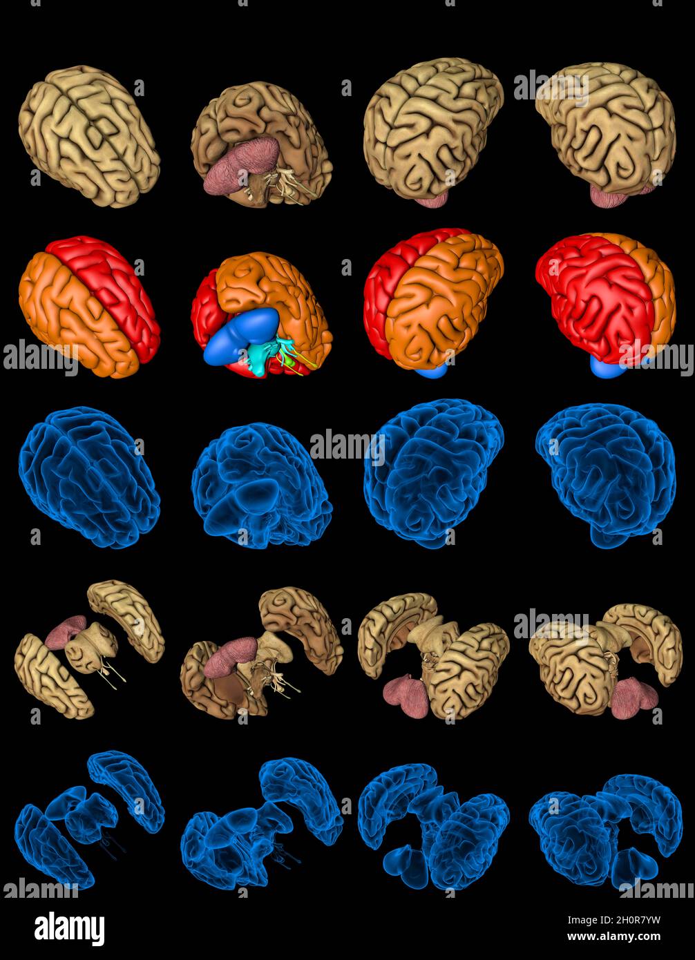 100 megapixels set - human brain with xray examination style image and ...