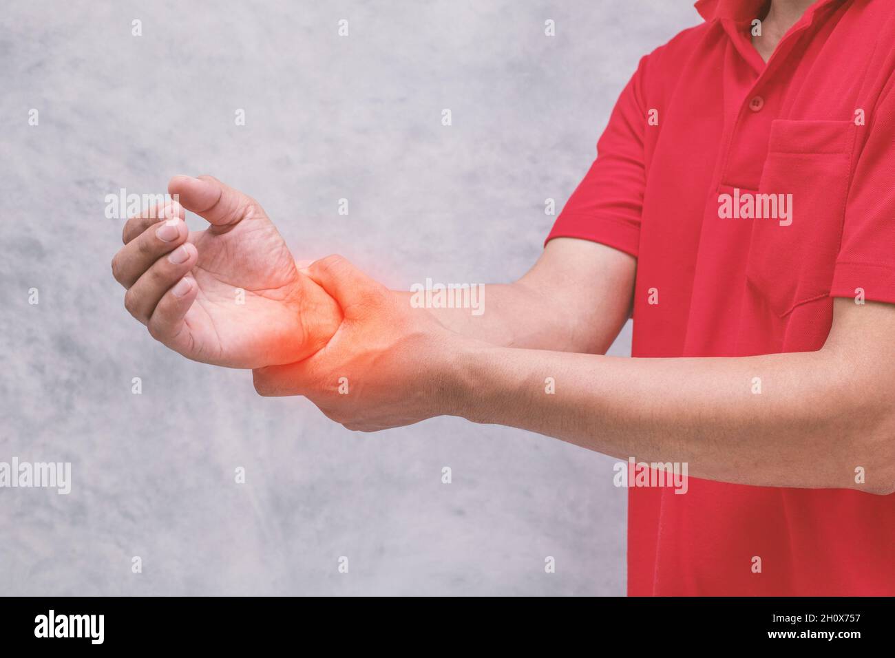 The wrist is swollen, red, inflamed due to exercise Stock Photo Alamy
