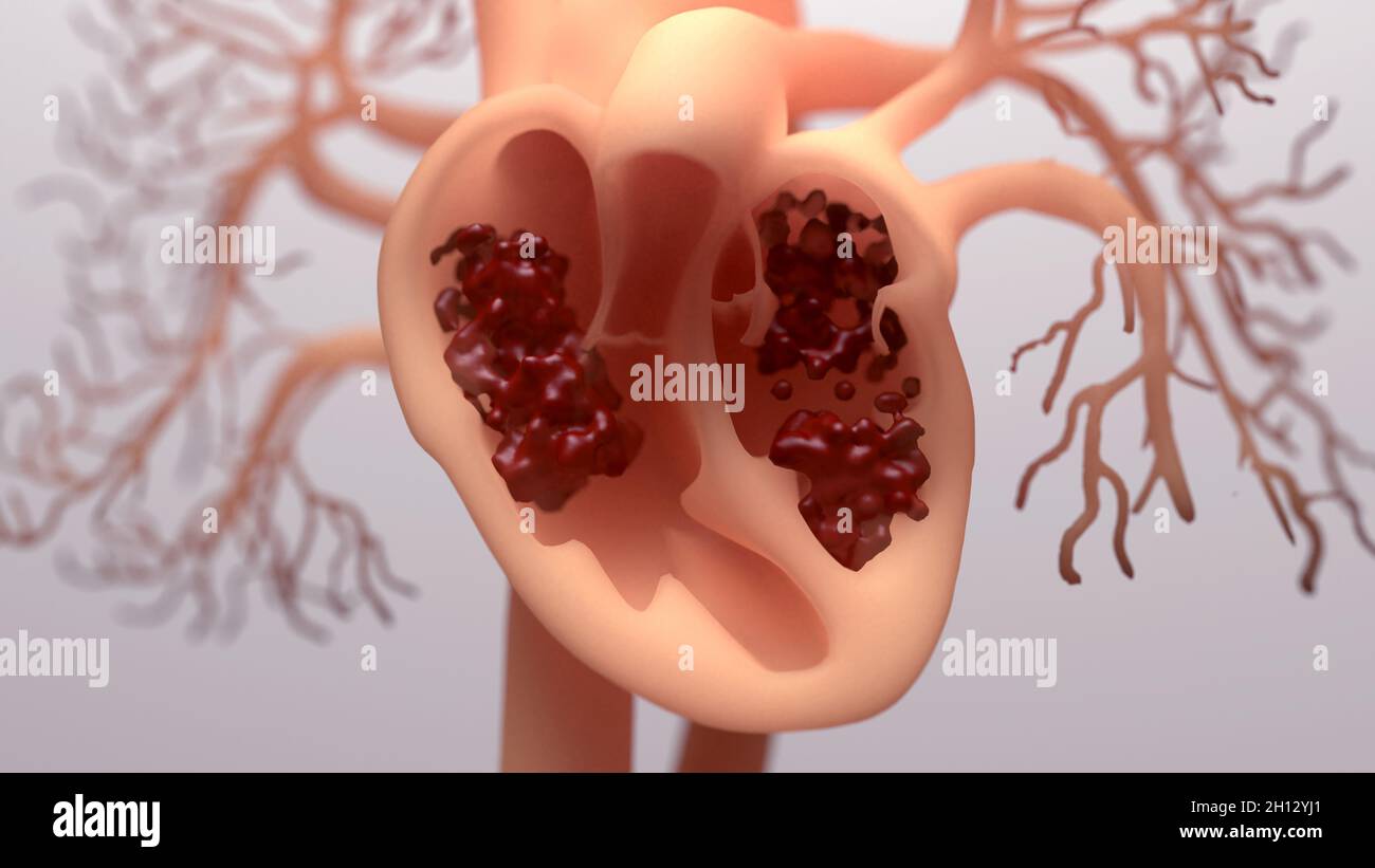 Blood pumping around a human heart, illustration Stock Photo Alamy