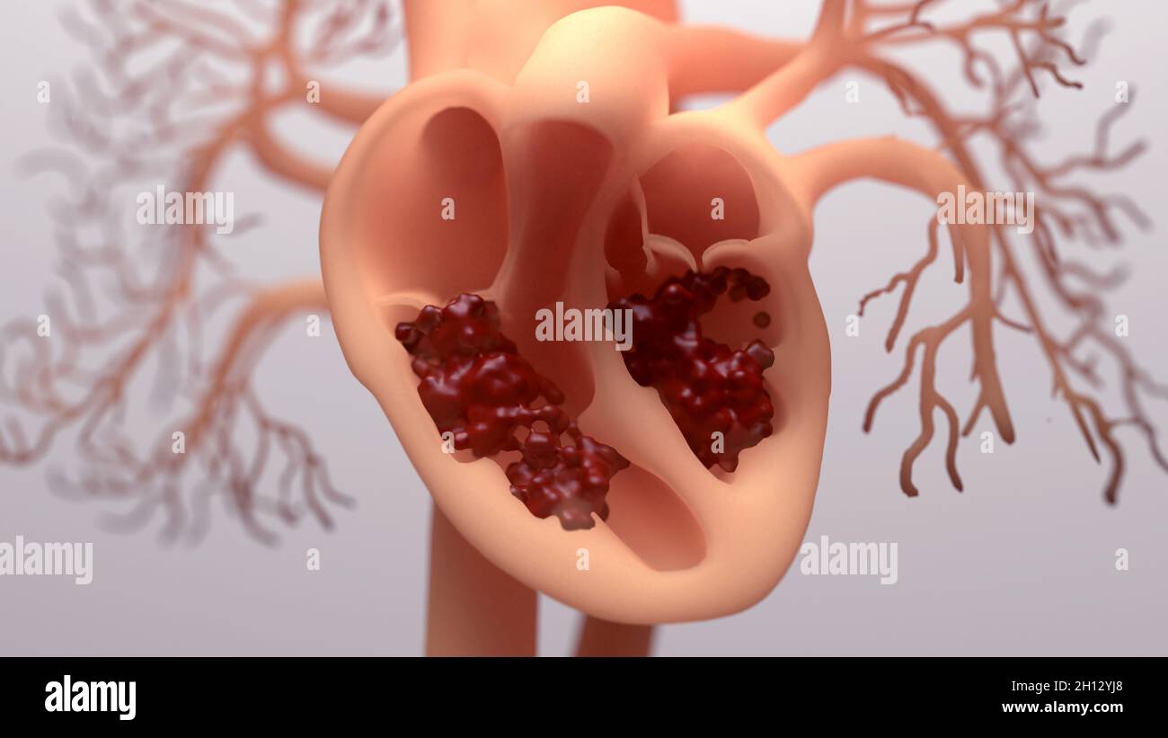 Blood pumping around a human heart, illustration Stock Photo Alamy