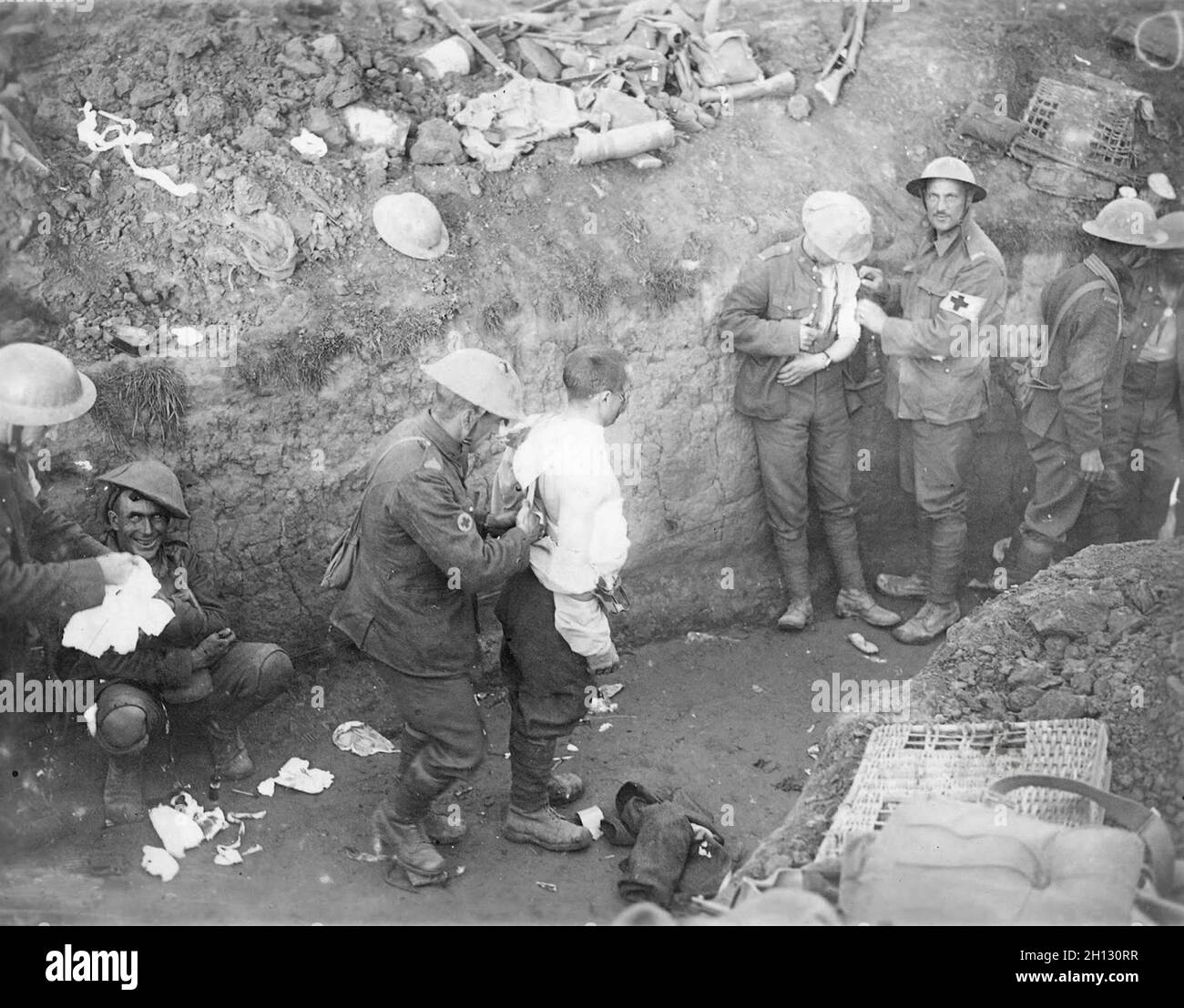 Wounded men beaing treated in a trench in WW1. The man on the left is suffering from shell shock. Stock Photo