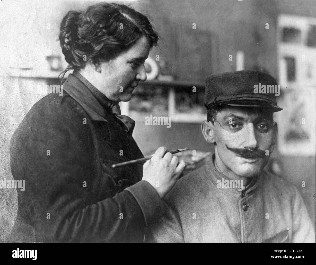 Anna Coleman Ladd fitting soldier with restorative face mask. Stock Photo