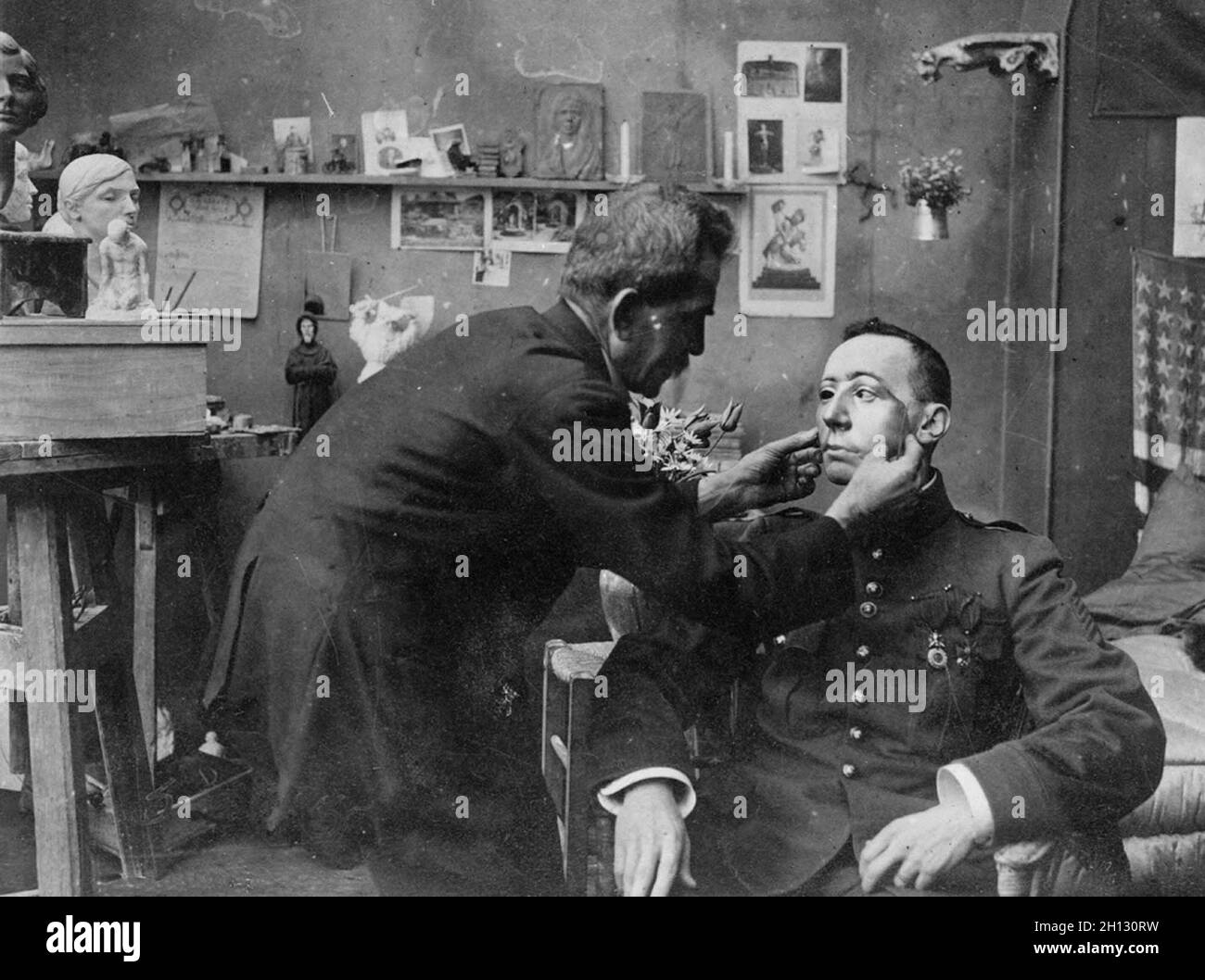 French soldier whose face was mutilated in World War I, being fitted with a mask made at the American Red Cross studio of Anna Coleman Ladd, 1918. Stock Photo