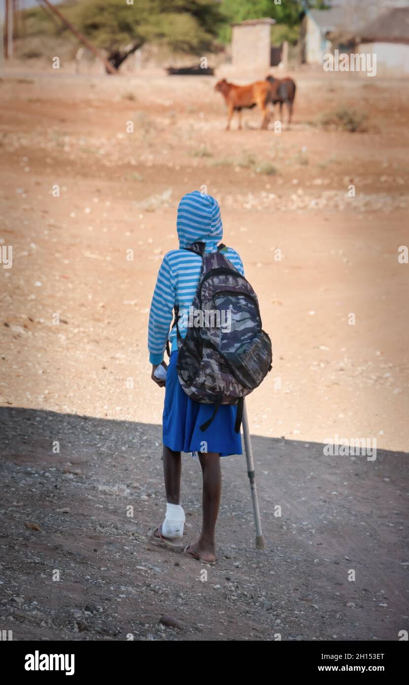 African child walking with a crutch and a hurt leg back to school, Stock Photo