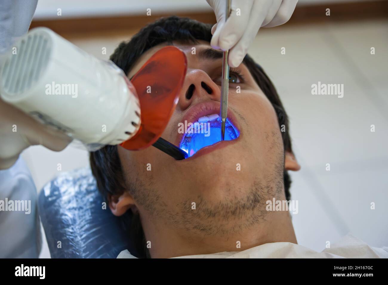 dentist ultraviolet light checking up the teeth of a young Caucasian man Stock Photo
