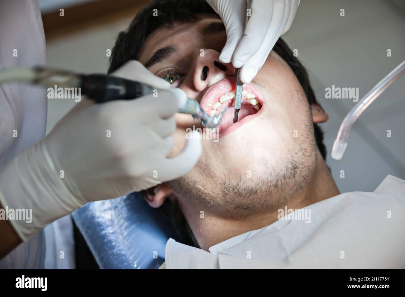 dentist checking up the teeth of a young Caucasian man Stock Photo