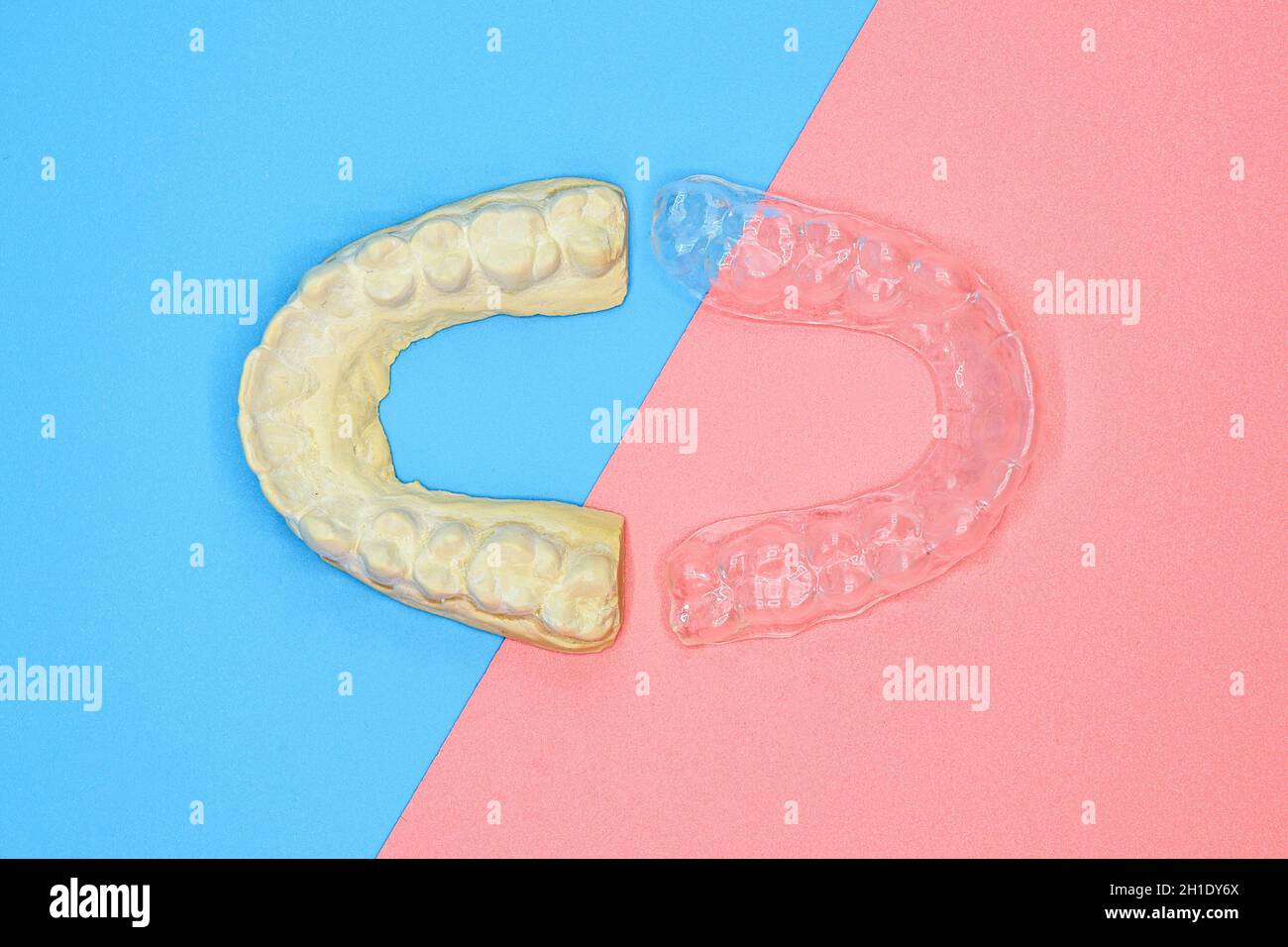 Plaster impression of teeth. Dental plaster mold and orthodontic silicone trainer. Mobile orthodontic appliance for dental correction, on blue and pin Stock Photo