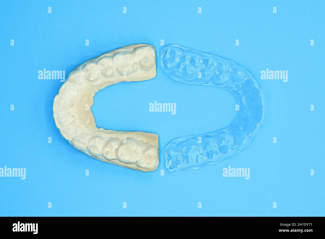 Plaster impression of teeth. Dental plaster mold and orthodontic