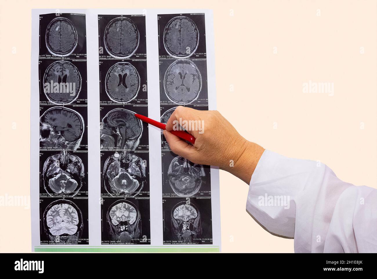 The magnetic resonance image or MRI of the male brain and hand of ...
