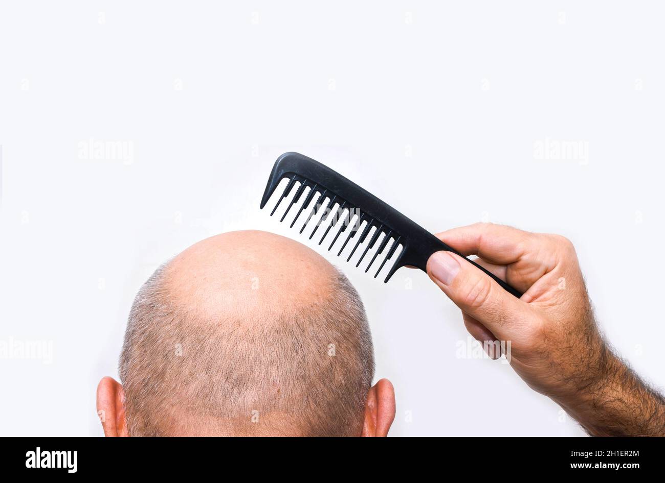 Human alopecia or hair loss - adult man hand holding comb on bald head Stock Photo