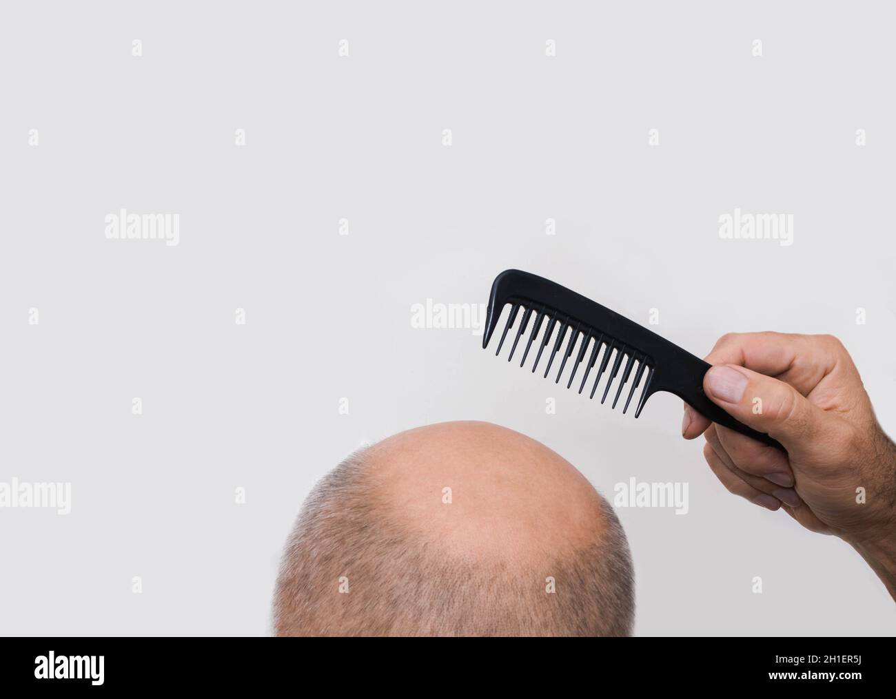 Human alopecia or hair loss - adult man hand holding comb on bald head Stock Photo