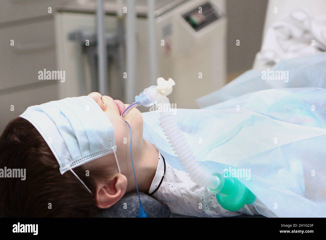 A child under anesthesia. Breathing tube in the trachea. Concept of