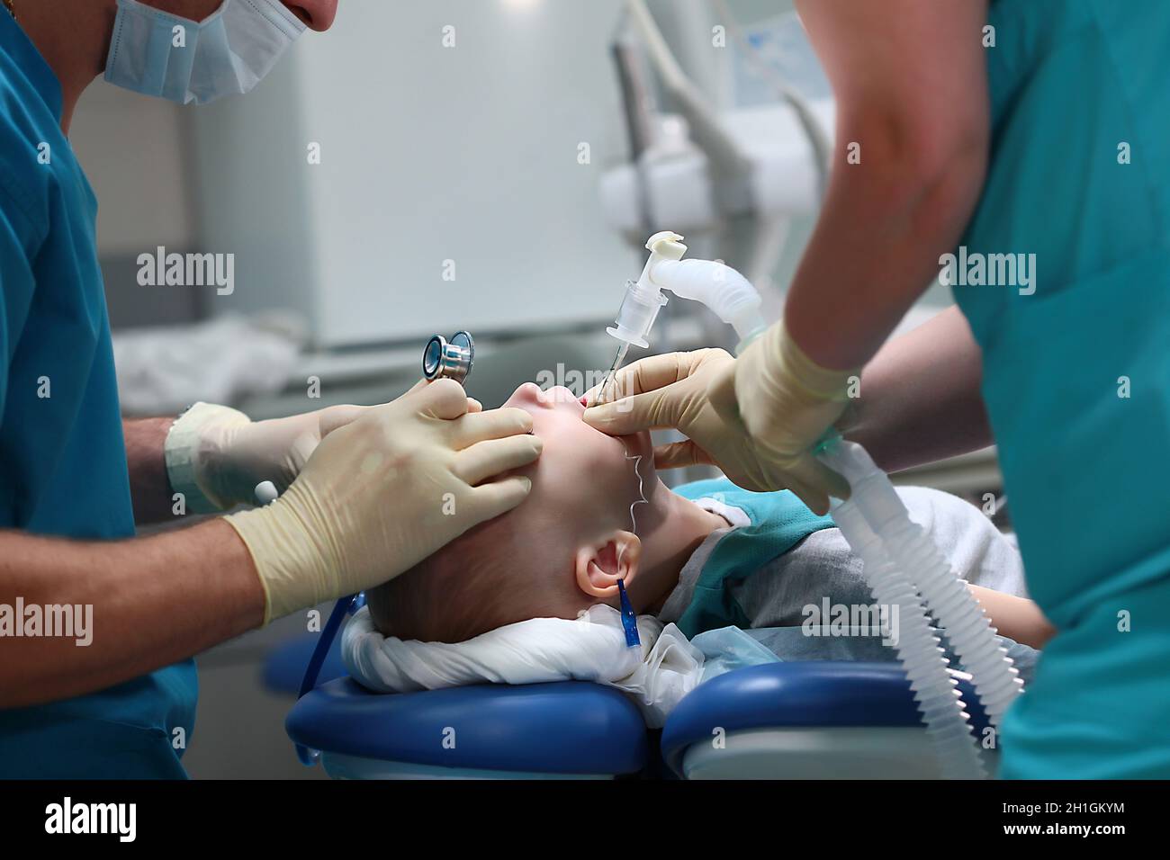An anesthesiologist inserts a breathing tube into the trachea of a