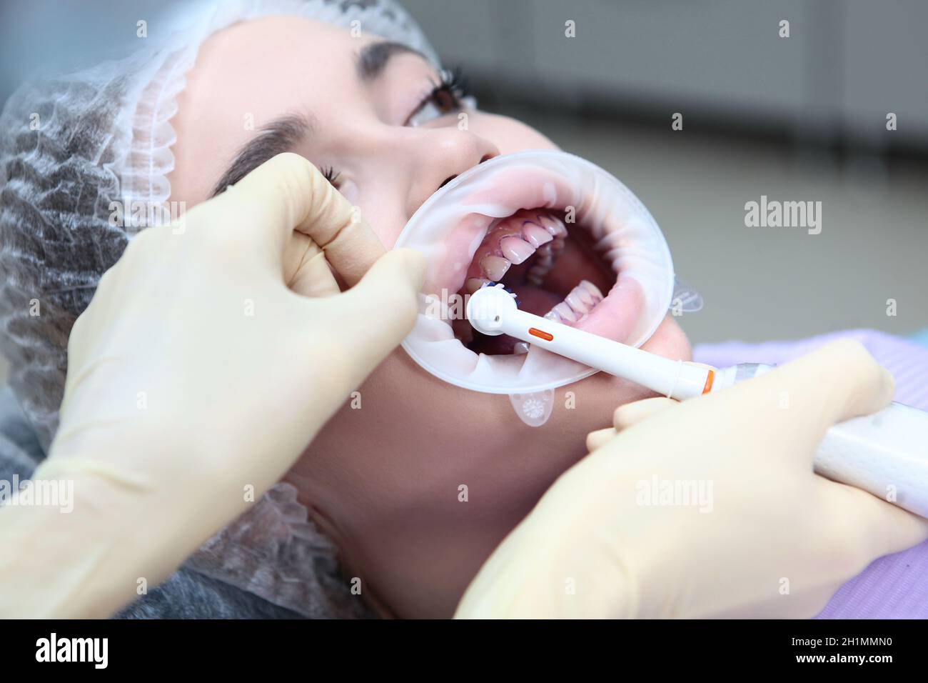 Professional teeth cleaning.Electric toothbrush in the hands of a dentist. A young girl at a