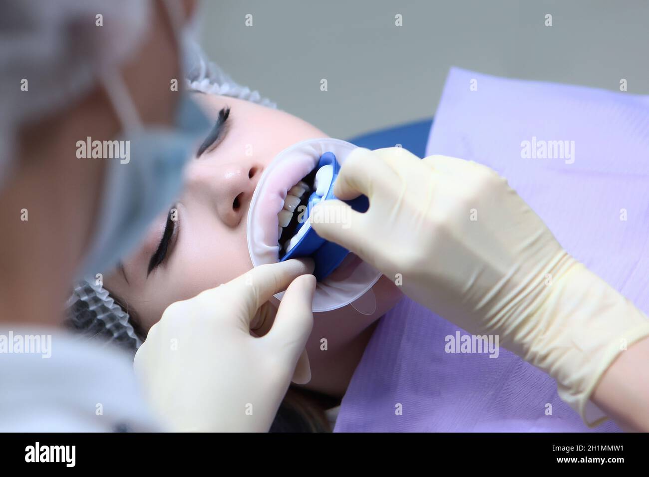 Professional dental and oral hygiene. The doctor applies a professional
