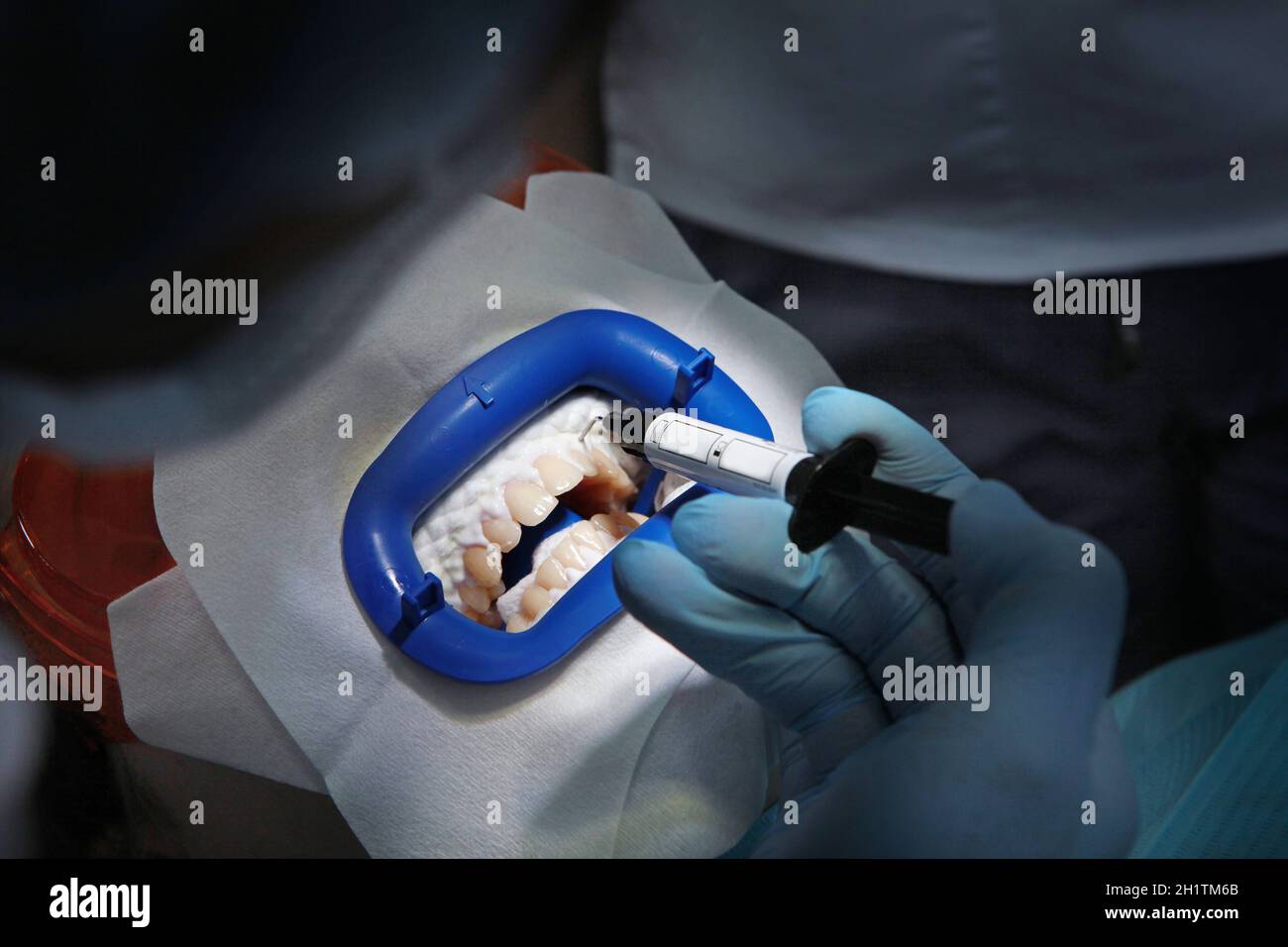 Preparation of patient for bleaching procedure.Teeth whitening in a dental clinic with cold
