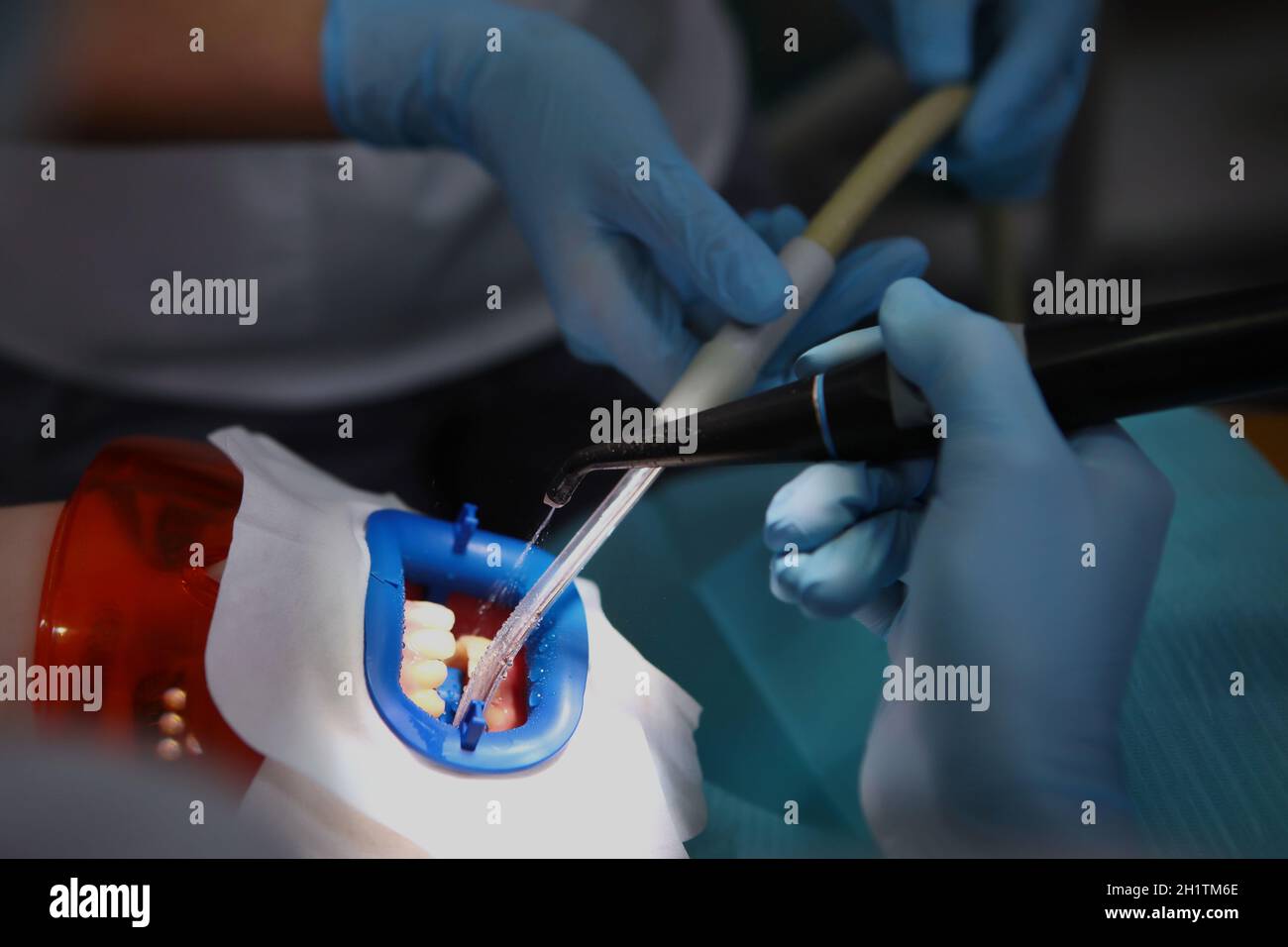 Dental instruments in patient's mouth.Preparation of oral cavity for