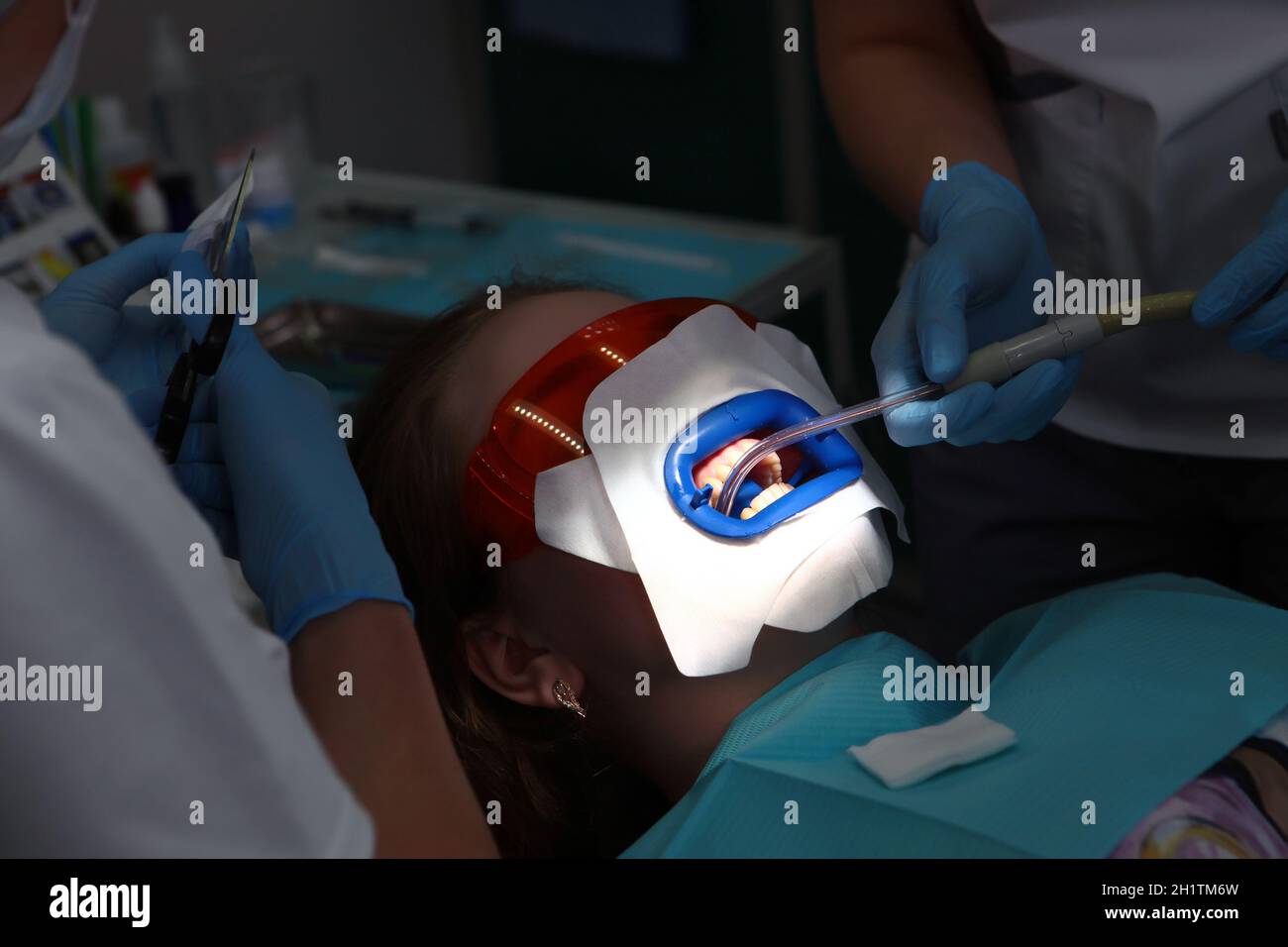 Preparation of patient for teeth whitening procedure.Teeth whitening in a dental clinic with