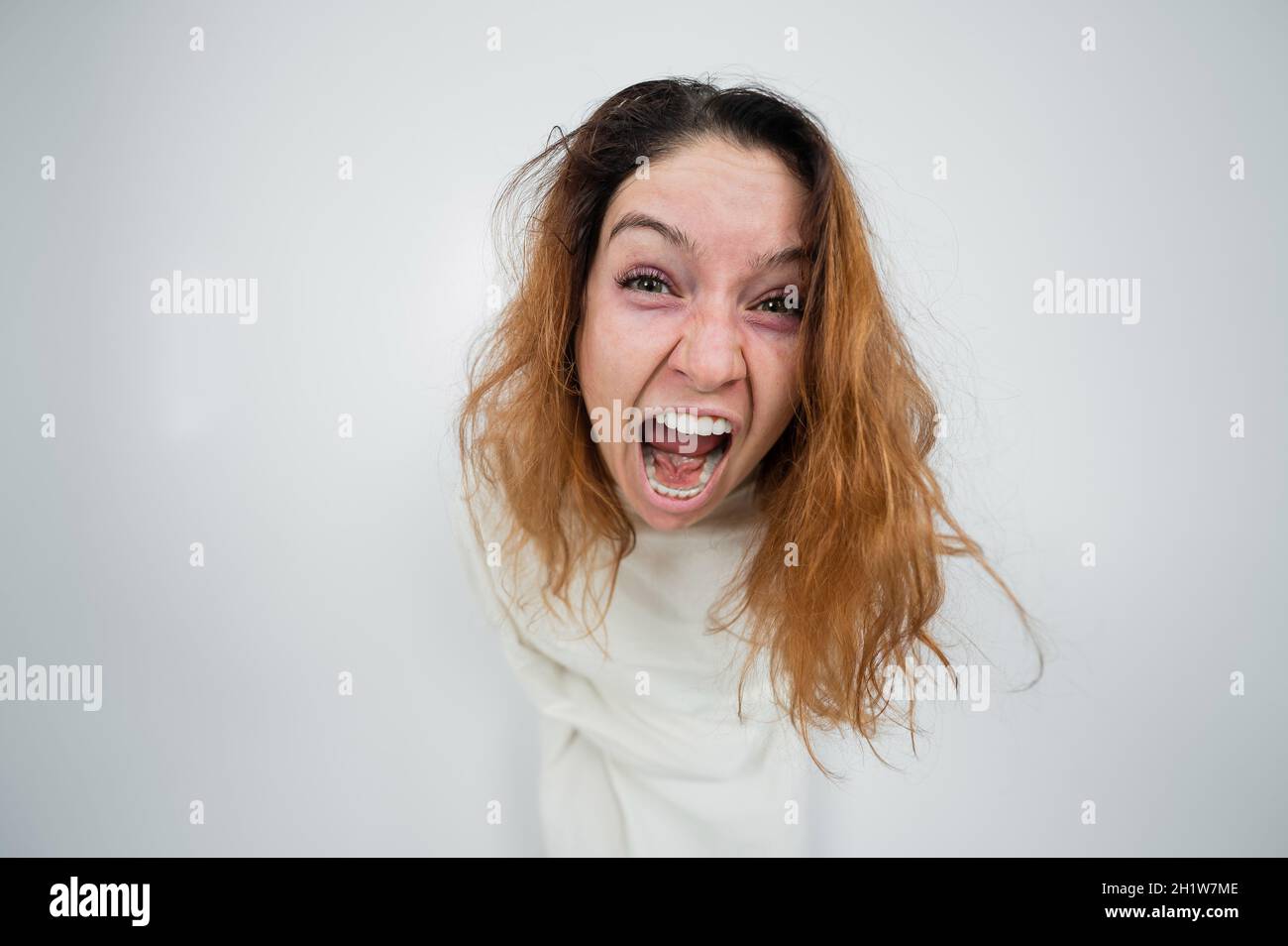 Mental hospital crazy girl hi-res stock photography and images - Alamy