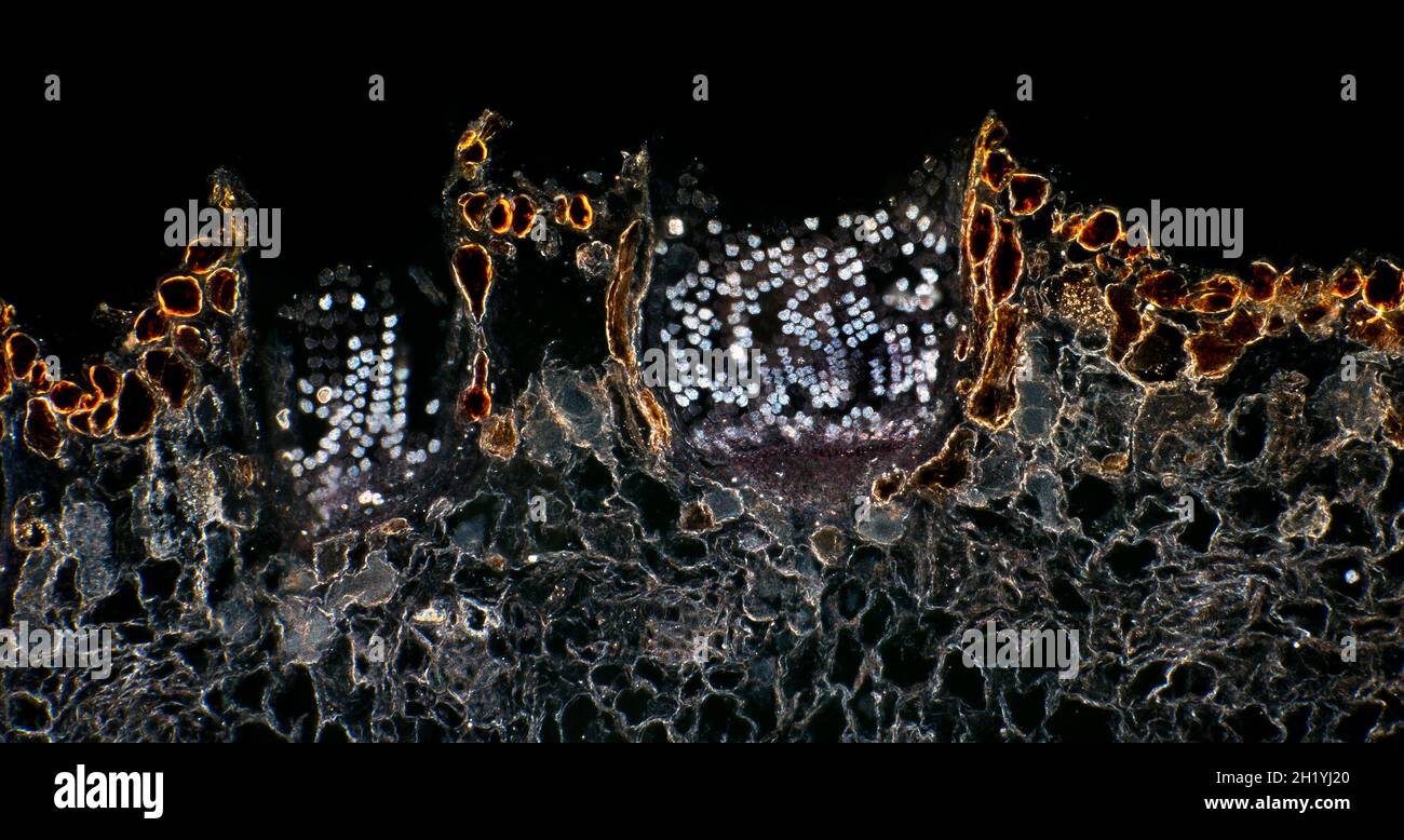 Fungi, Puccinia graminis, teleutospores in wheat stem, TS, Darkfield photomicrograph, rust fungus Stock Photo