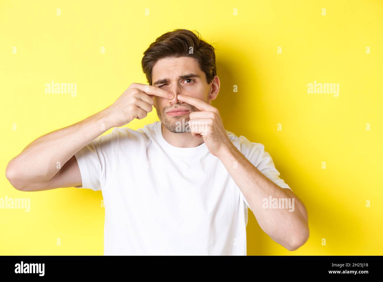 Young man squeezing pimple on nose, standing over yellow background. Concept of skin care and acne Stock Photo