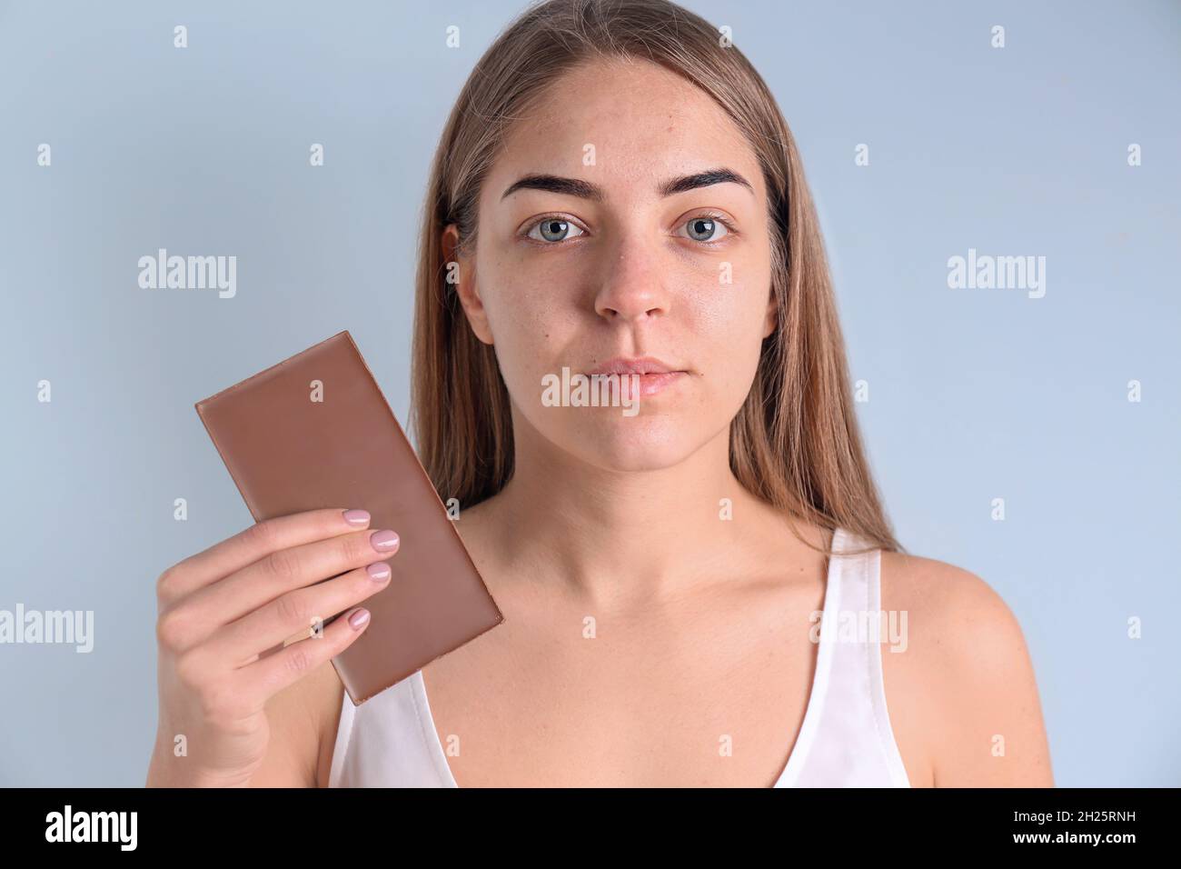 Young woman with acne problem holding chocolate bar on light background