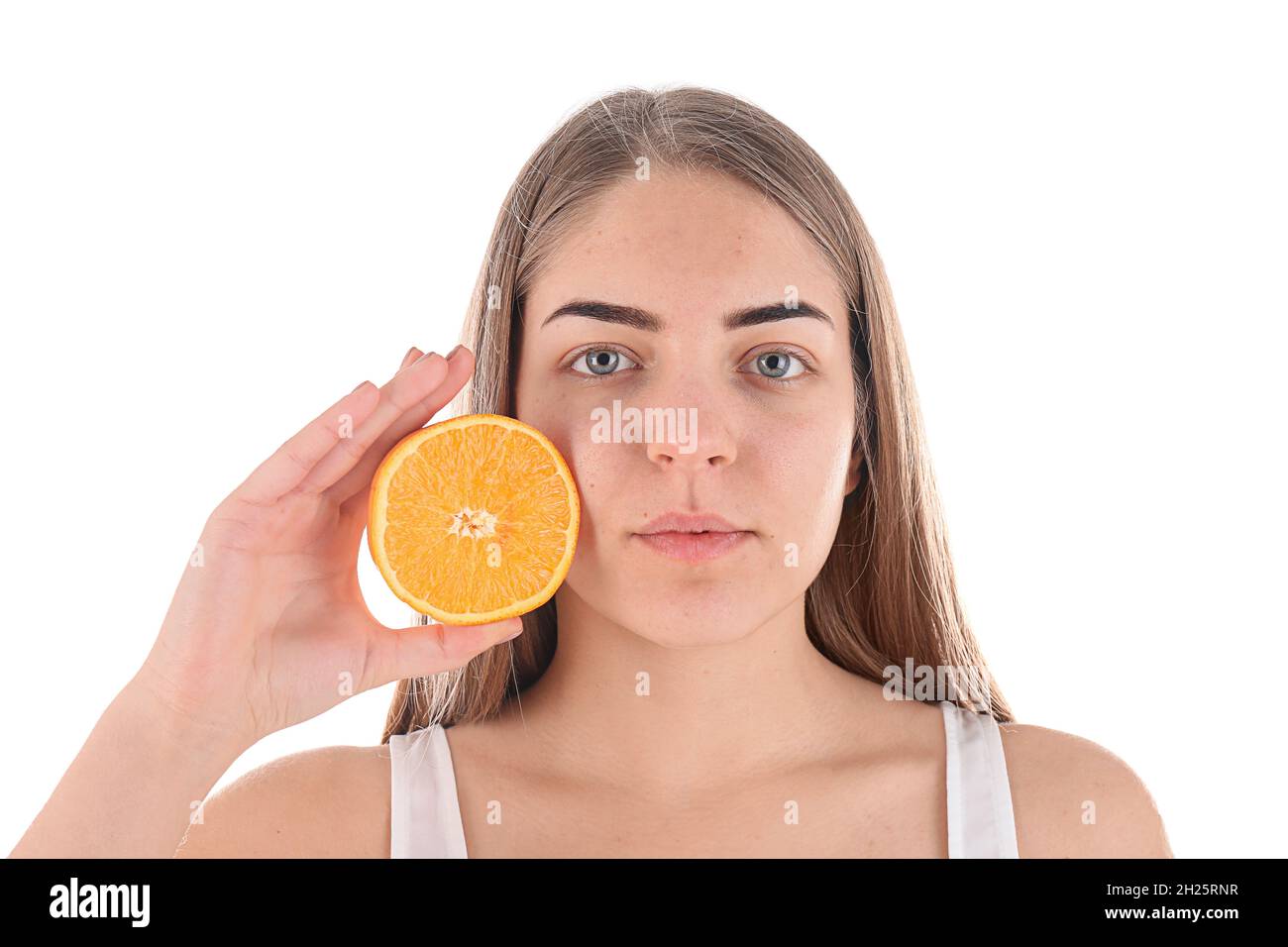 Young woman with acne problem holding orange on white background. Skin
