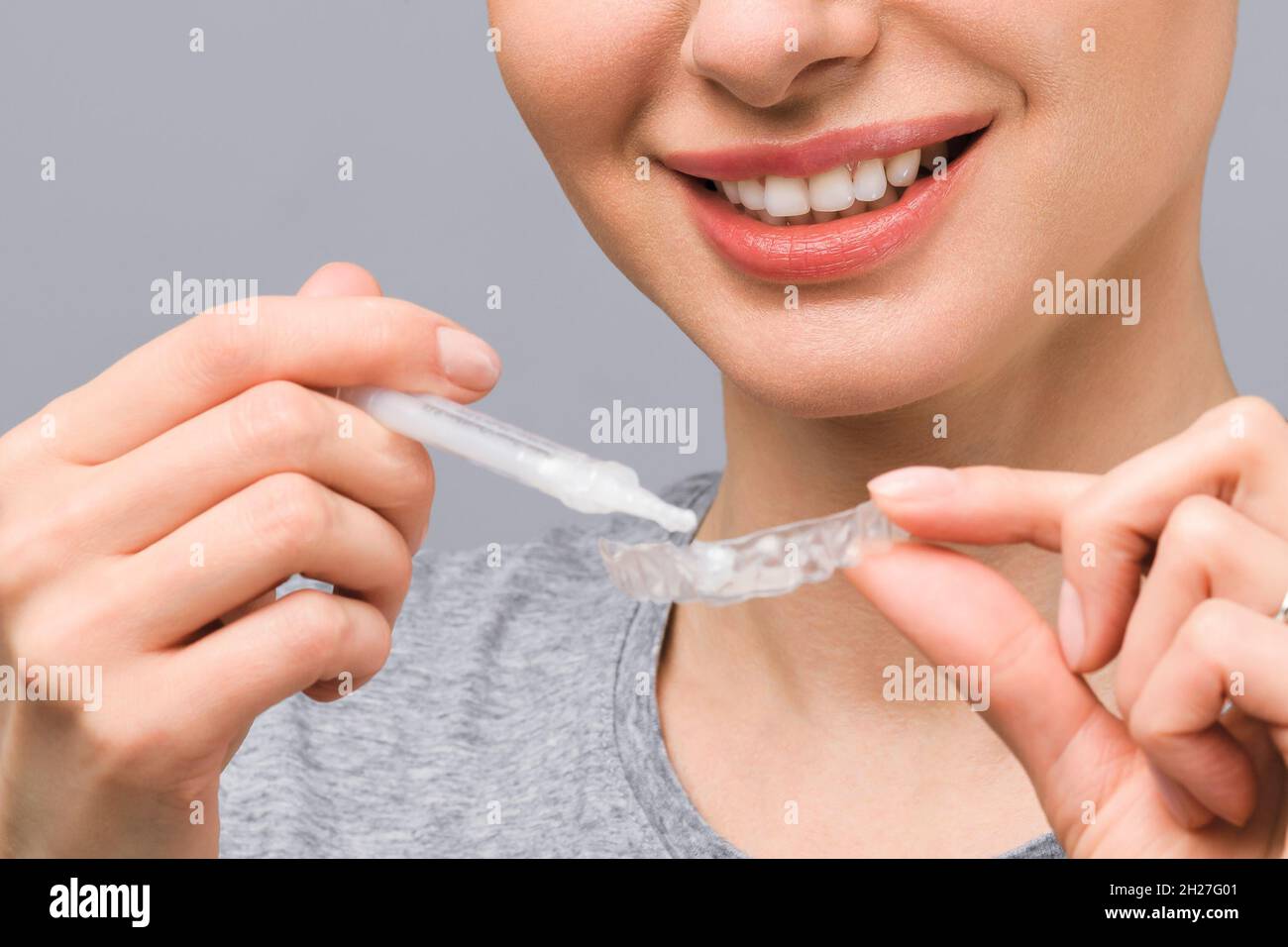 A young woman does a home teeth whitening procedure. Whitening tray