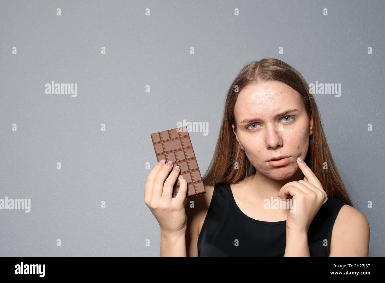 Young woman with acne problem holding chocolate bar on color background