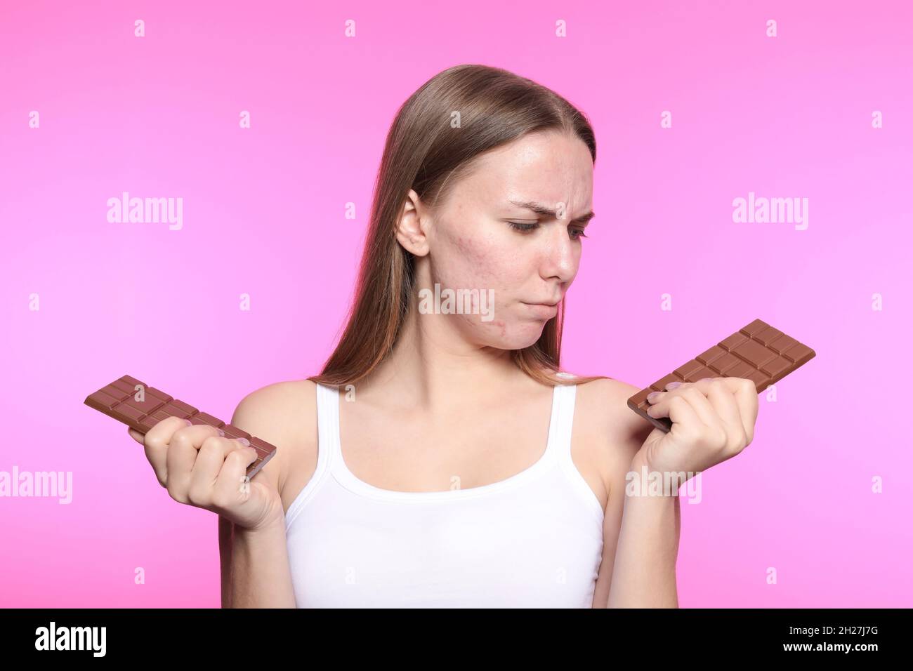 Young woman with acne problem holding chocolate bars on color