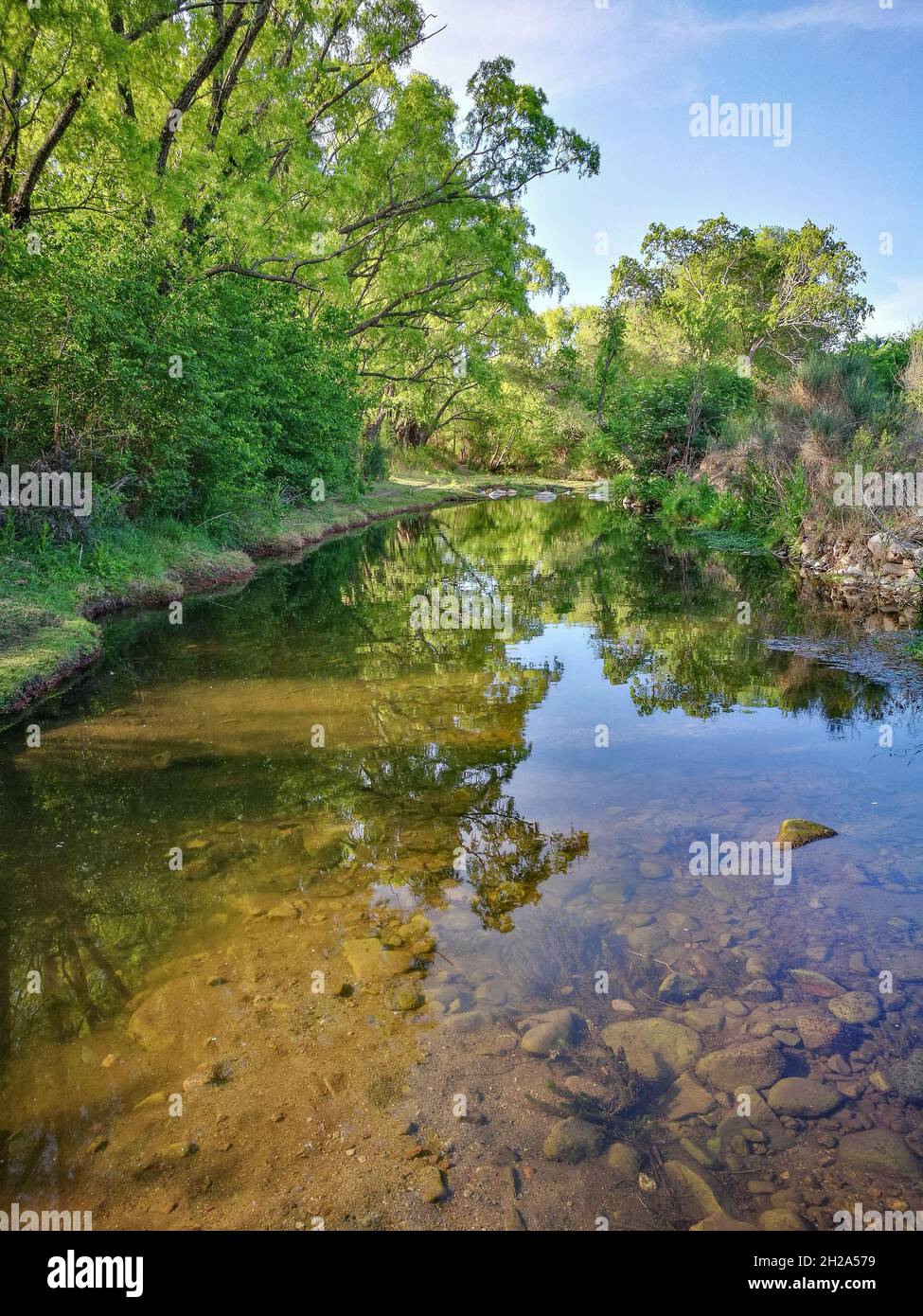 Vertical shot of a reflective lake surrounded by green trees under a ...