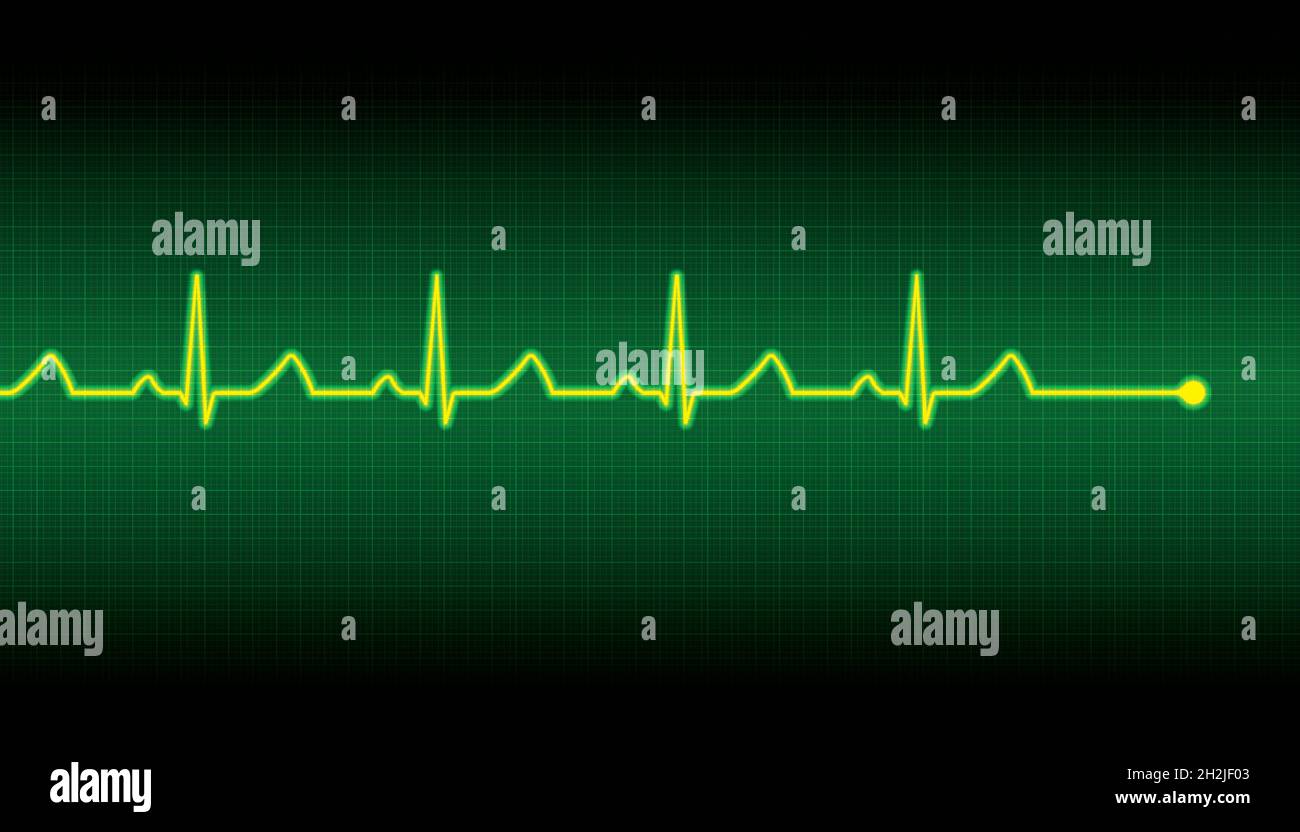 Vector illustration of a heart pulse Stock Vector