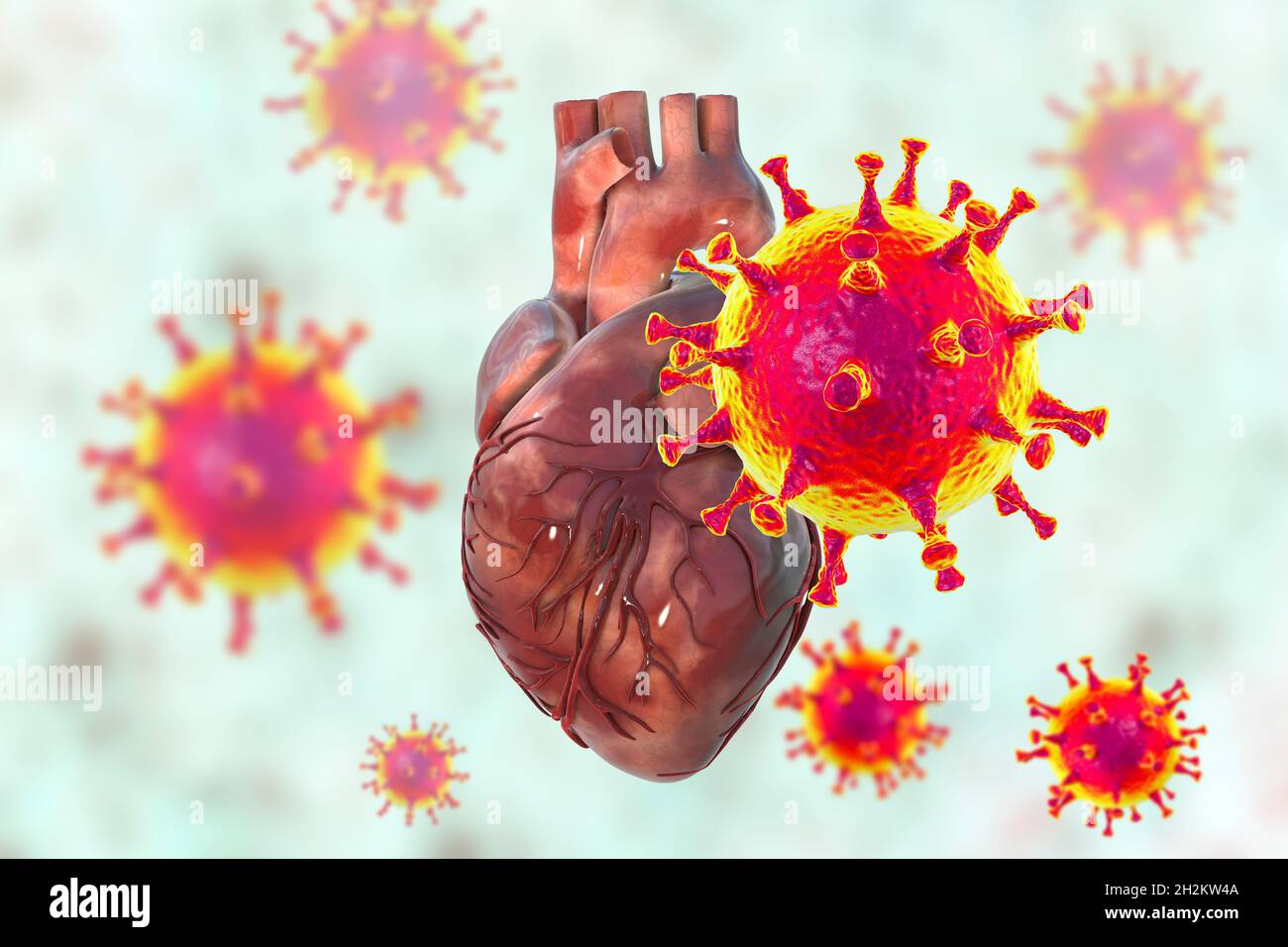 Covid-19 viruses affecting the heart, illustration Stock Photo