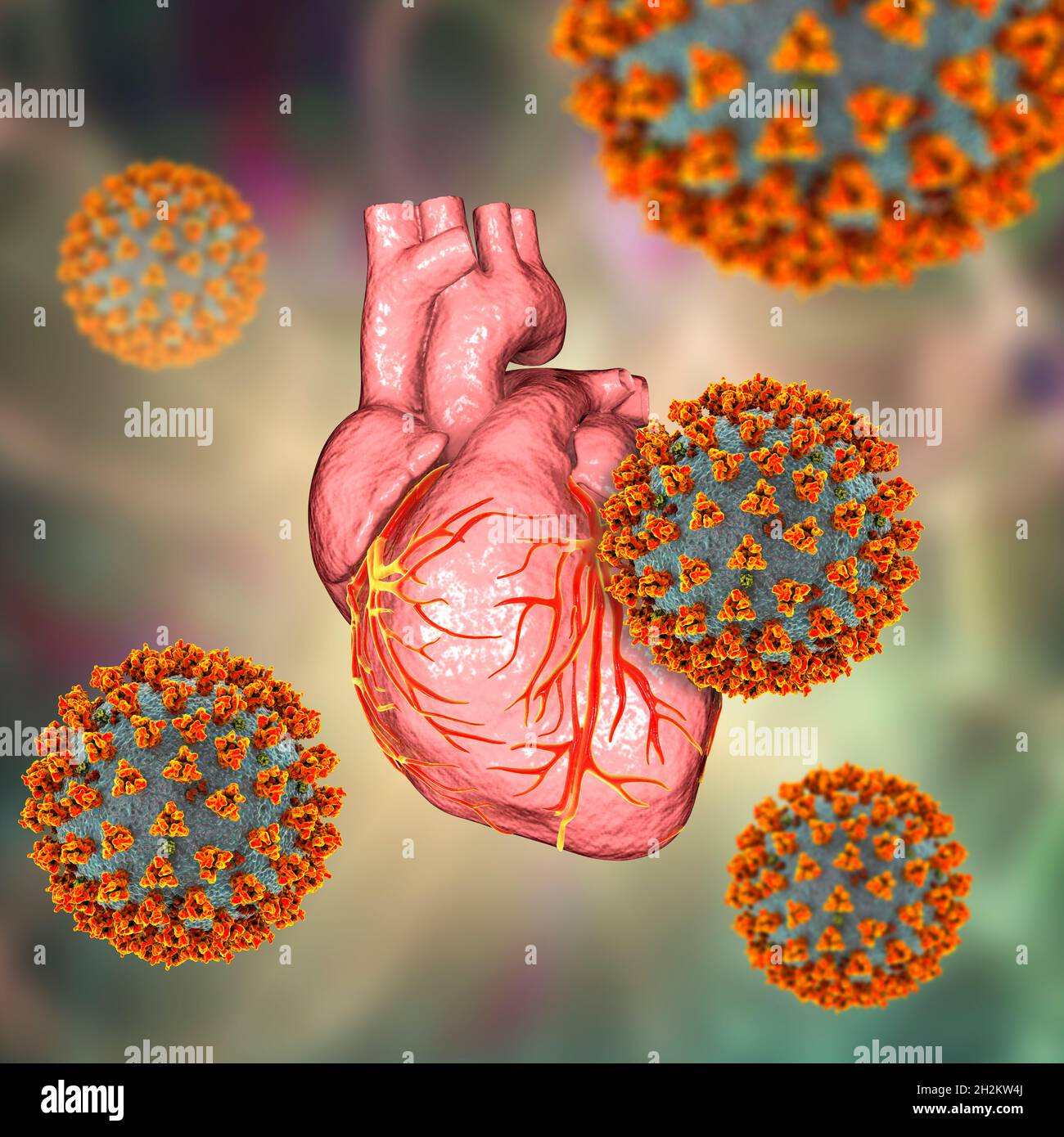 Covid-19 viruses affecting the heart, illustration Stock Photo