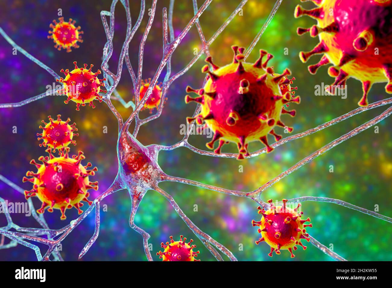 Viral encephalitis, conceptual illustration Stock Photo - Alamy