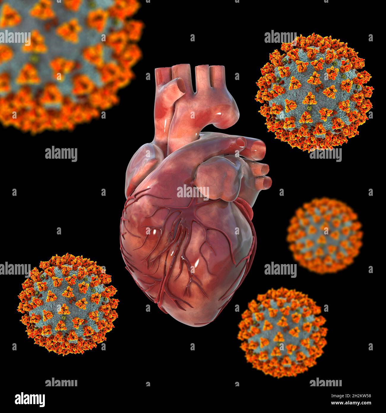 Covid-19 viruses affecting the heart, illustration Stock Photo