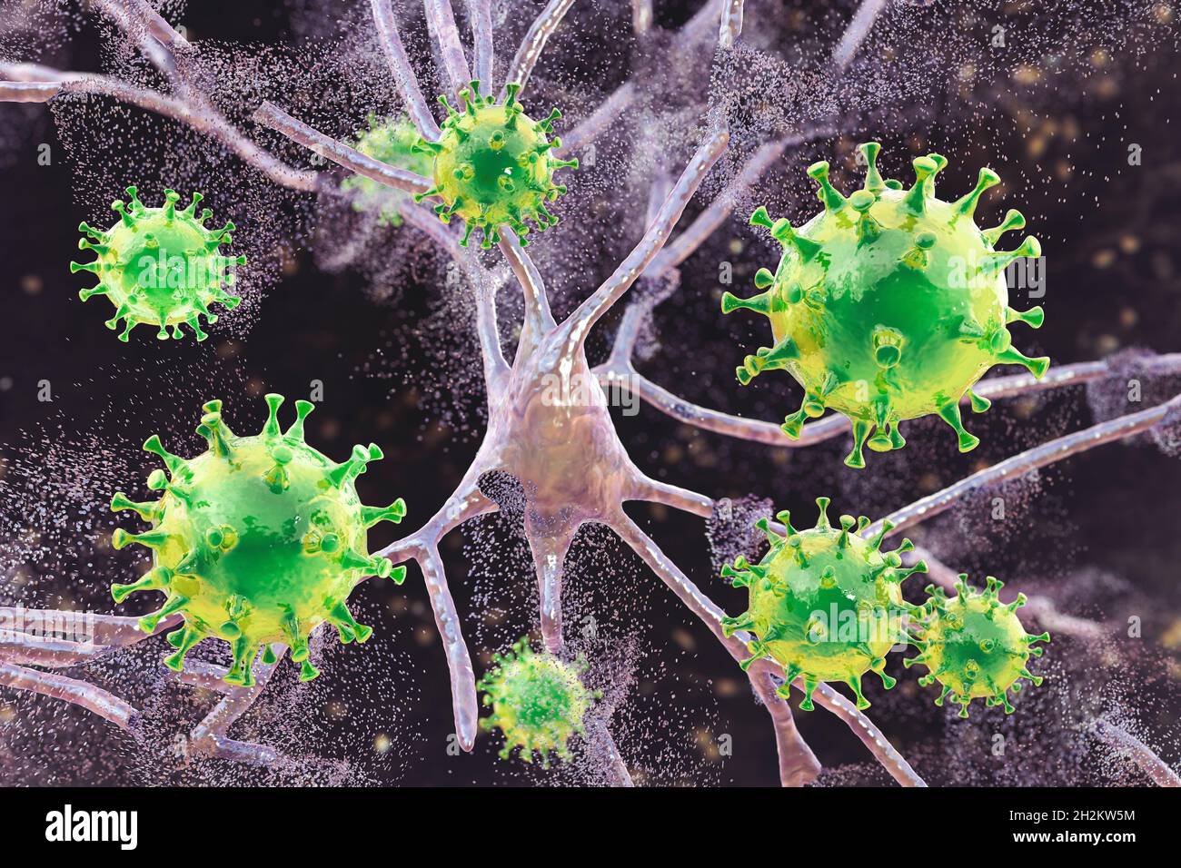 Viral encephalitis, conceptual illustration Stock Photo - Alamy