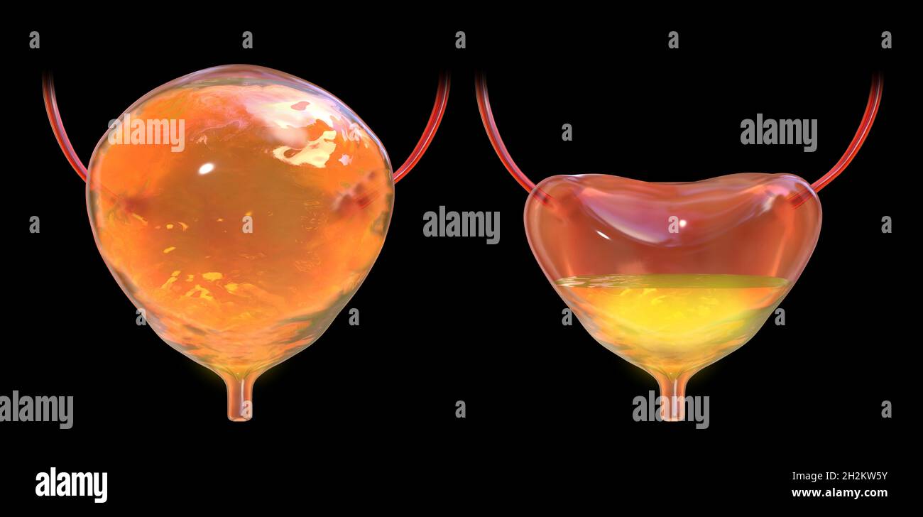Overactive bladder, illustration Stock Photo Alamy