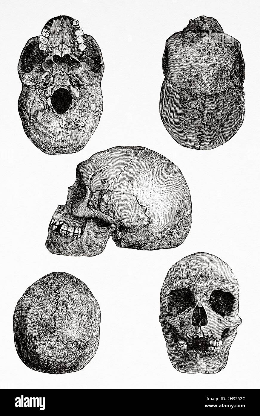 Skull of a Native Australian indigenous man from Rockhampton, central Queensland, Australia. Old 19th century engraved illustration, Journey to Northeast Australia by Carl Lumholtz 1880-1884 from Le Tour du Monde 1889 Stock Photo