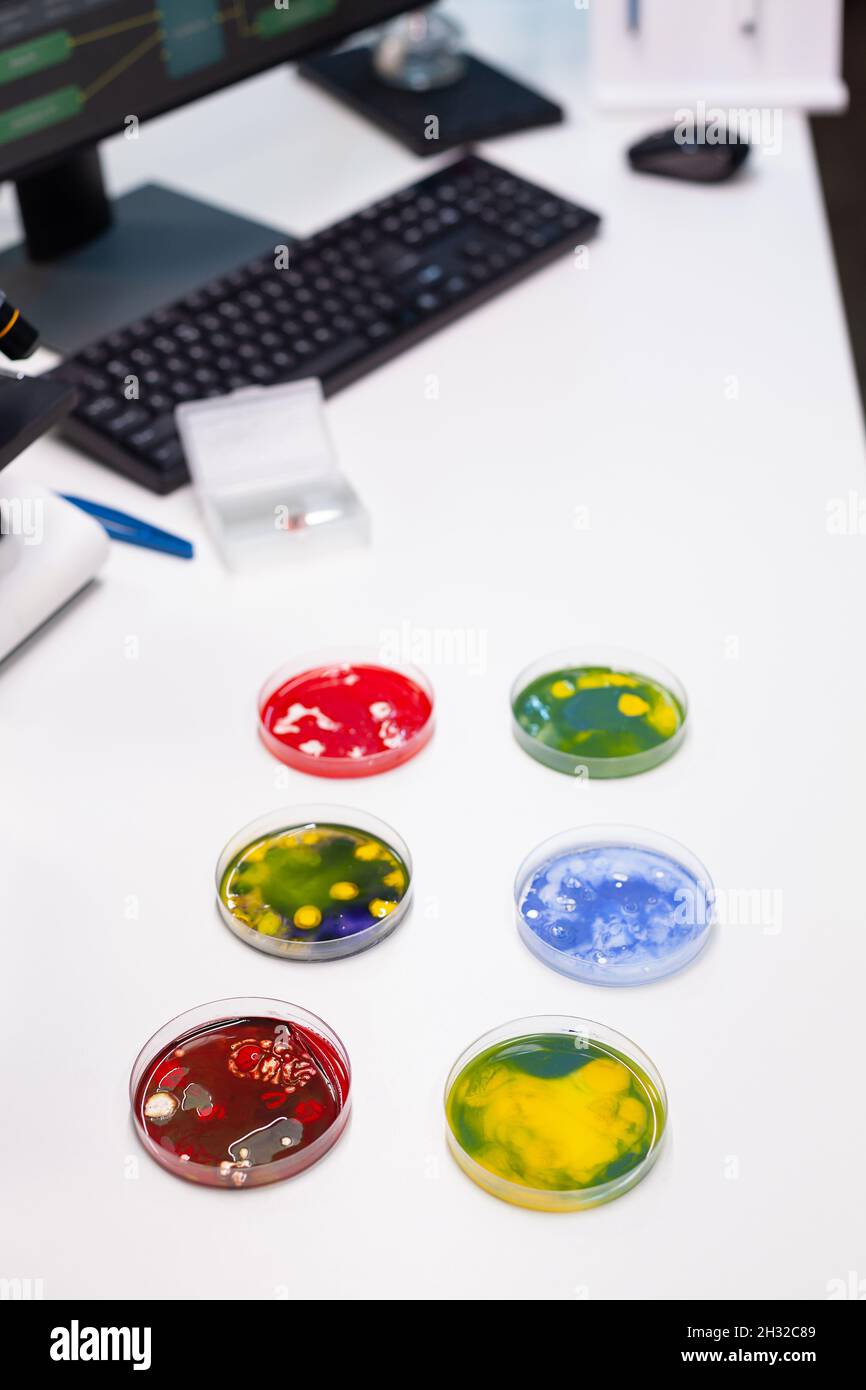 Close up of petri dish with bacteria and virus on desk. Examination