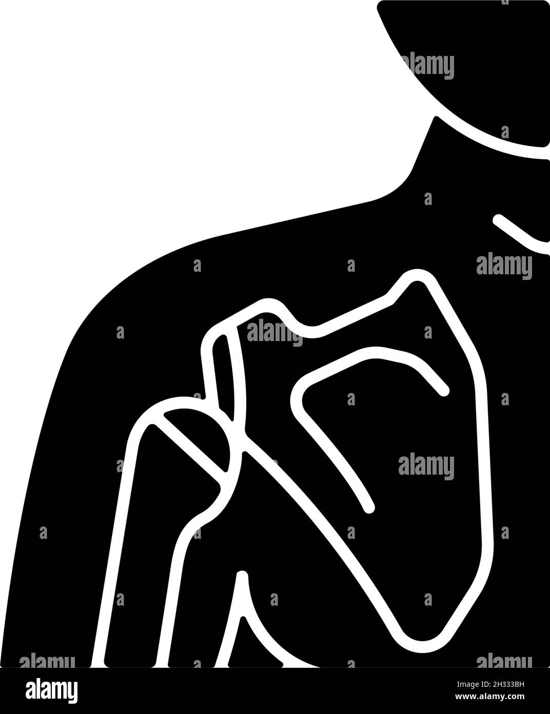 Joint dislocation black glyph icon Stock Vector Image & Art - Alamy