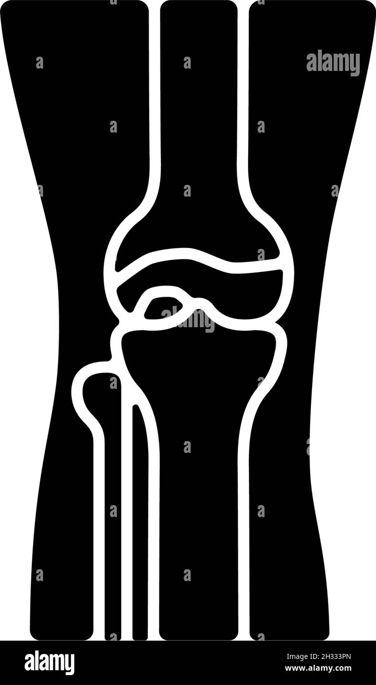 Osteoarthritis black glyph icon Stock Vector Image & Art - Alamy