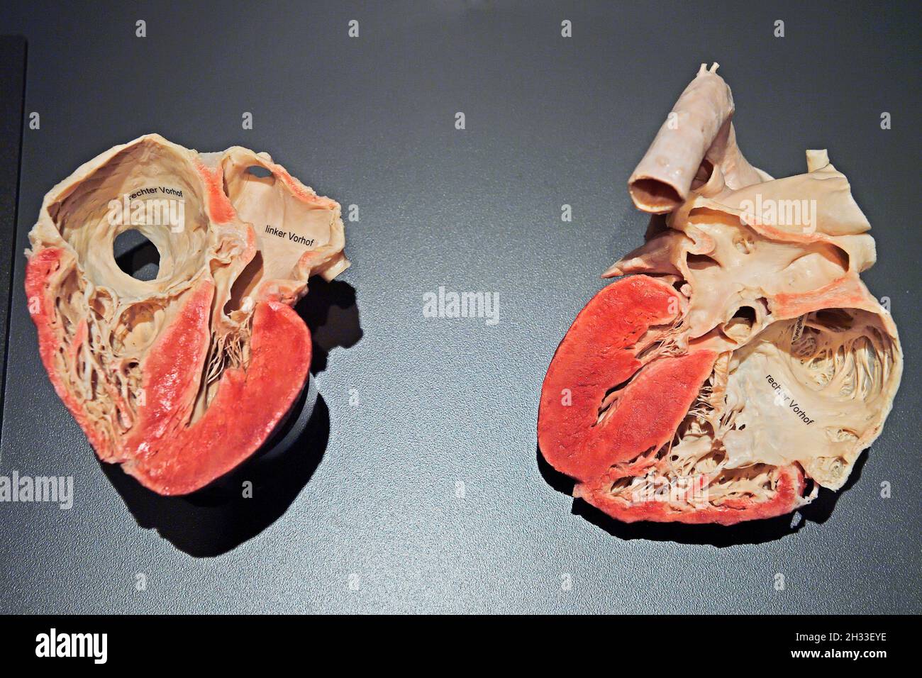 Präparat, Plastinat, eröffnetes menschliches Herz,  Körperwelten-Museum, Menschen Museum, Berlin, Deutschland Stock Photo