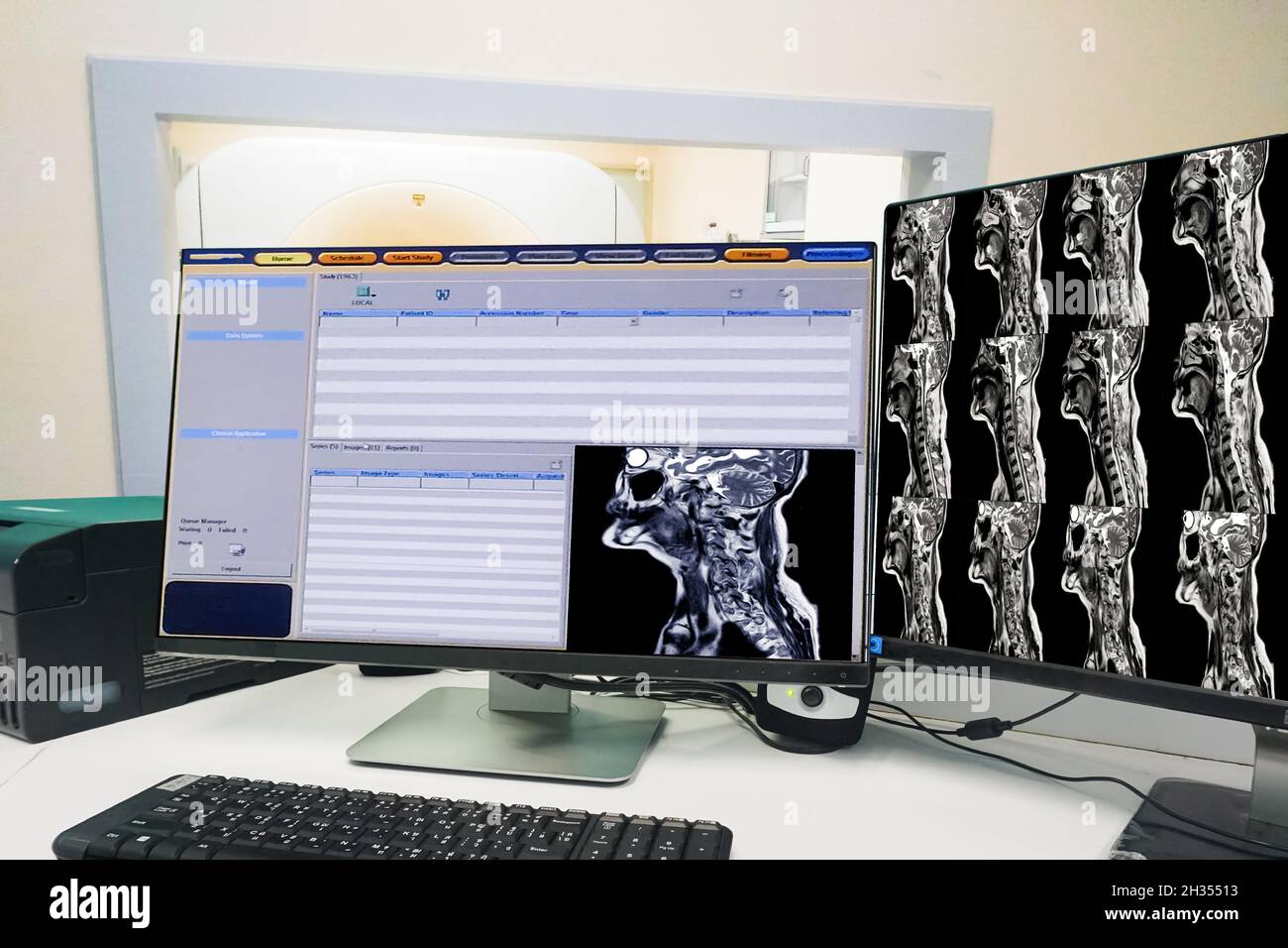 MRI Scan control room and computer showing cervical spine scan, Medical technology concept Stock Photo