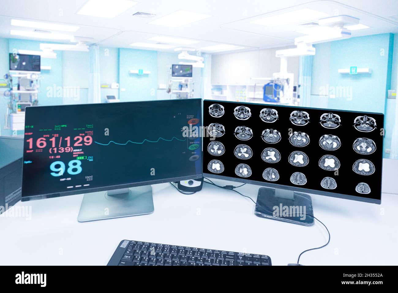 Motion blur in the emergency room hospital, a monitor showing Vital signs, and MRI brain scan , Medical healthcare concept. Stock Photo