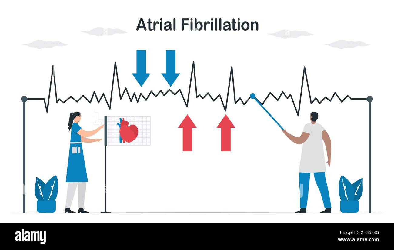 ECG signal of atrial fibrillation. Doctors check and analyze a heart disease. Cardiology vector illustration. Stock Vector